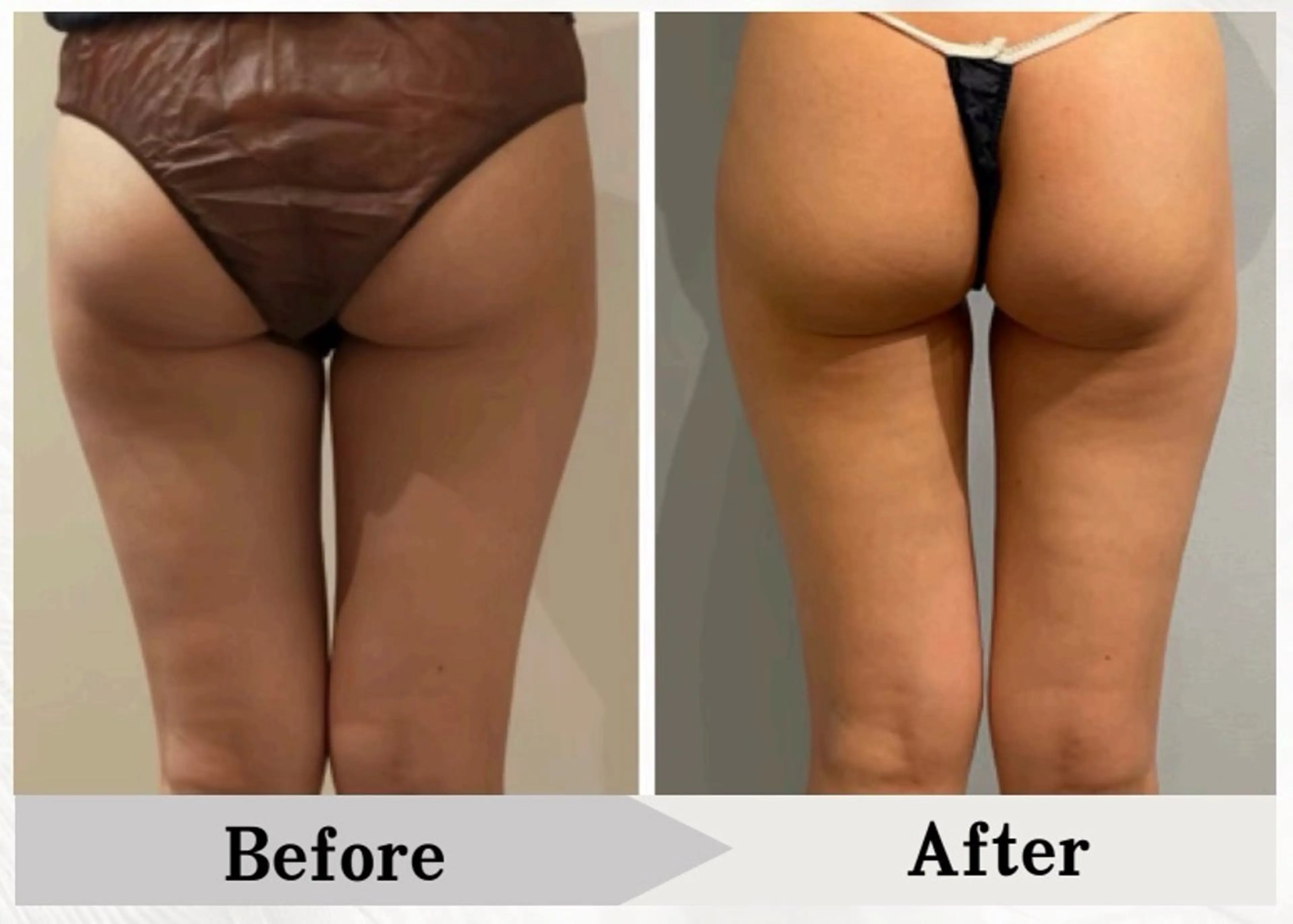 BAUM坂戸 ヘッドスパのエステ・リラクイメージ