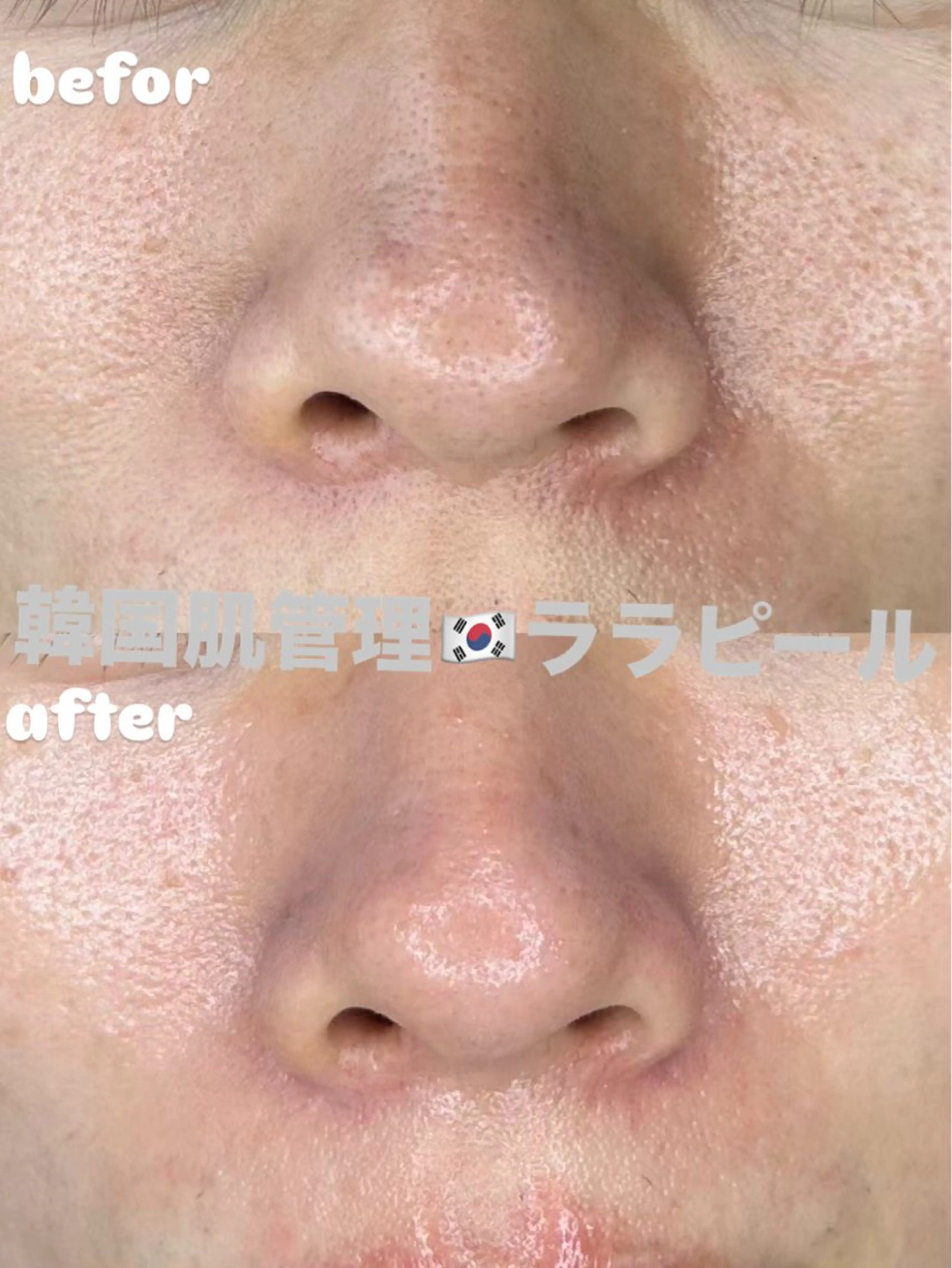 EstheticSalonReTweet所属・竹谷 春希のエステ・リラクイメージ