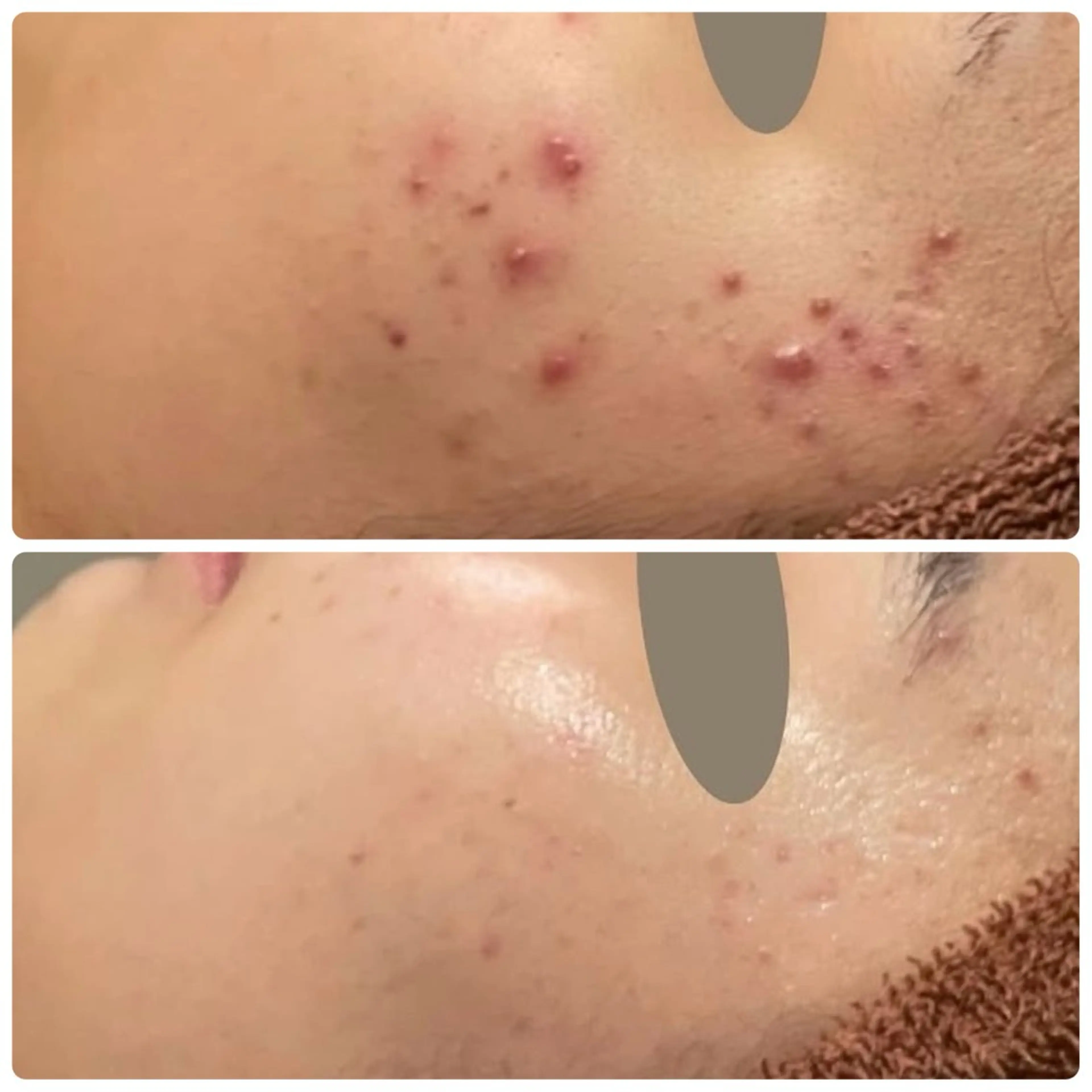 Lutan Richeさいたま店所属・ルタンリッシュ さいたま店のエステ・リラクイメージ