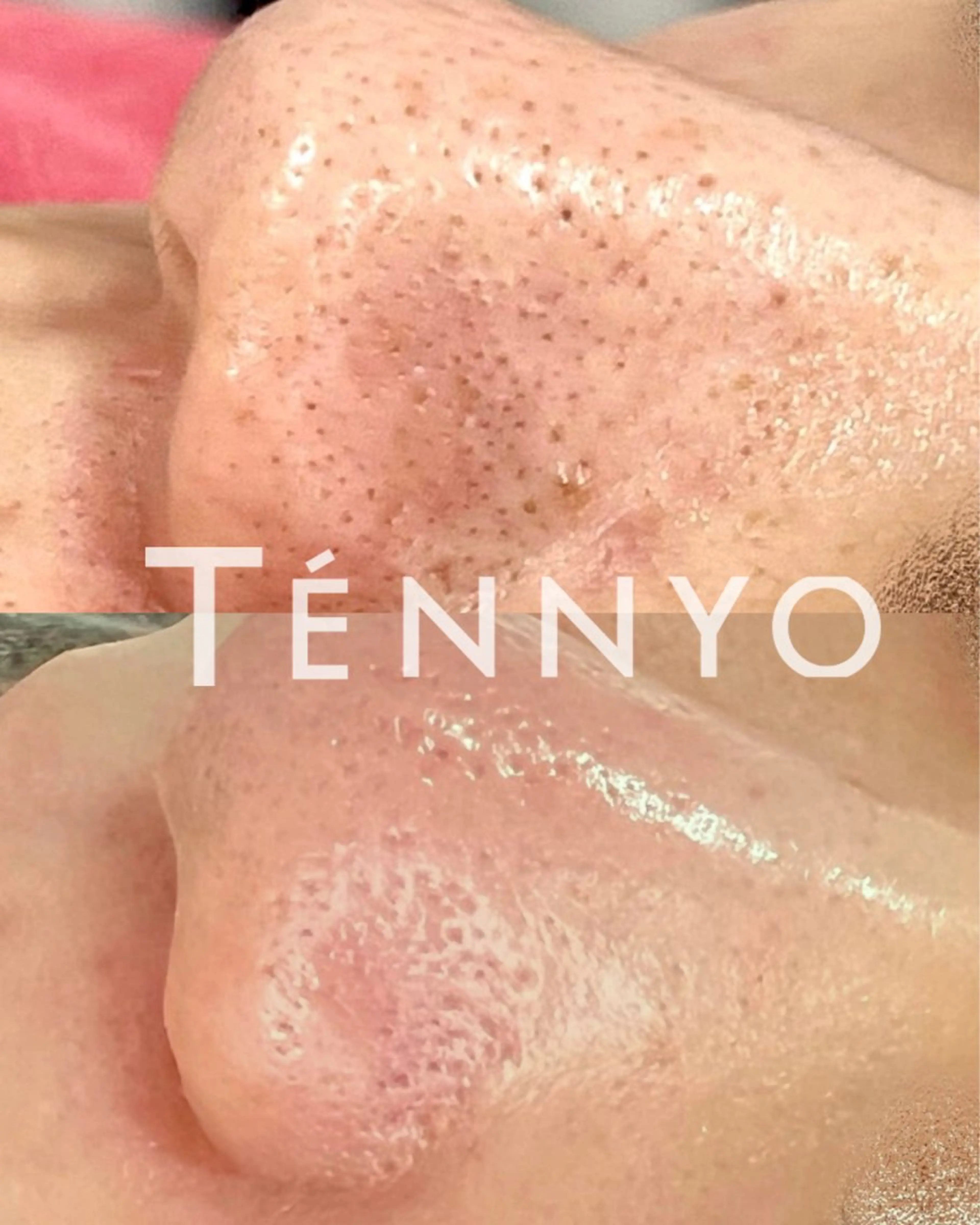 【毛穴の悩みから解放】ポアリファインフェイシャル💎導入記念✨8000円→初回6800円✨の写真