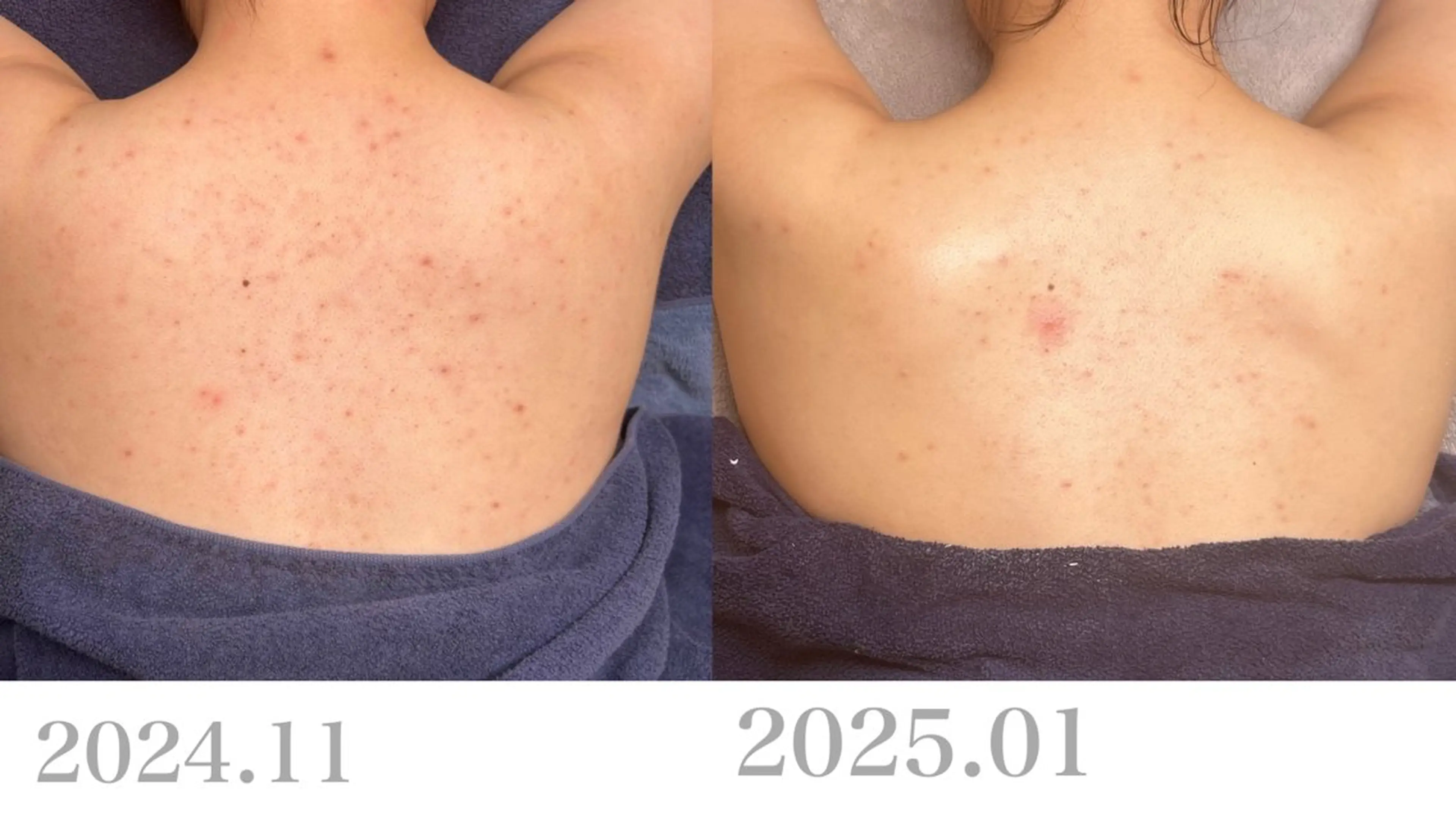 エステ リラク Le cherienのエステ・リラクイメージ