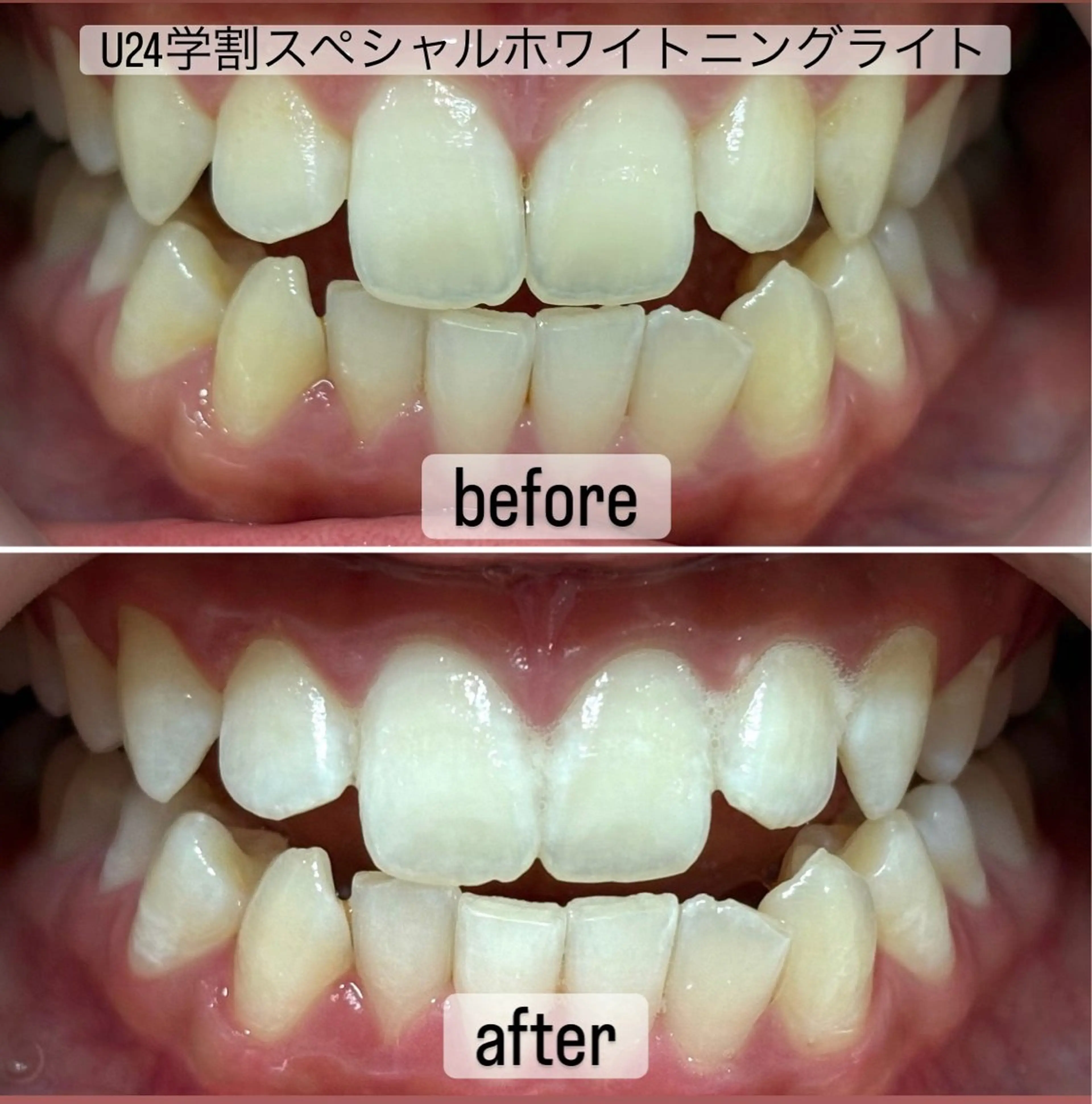 その他 whitening salon yatto.所属・ホワイトニングサロン yatto.のその他イメージ
