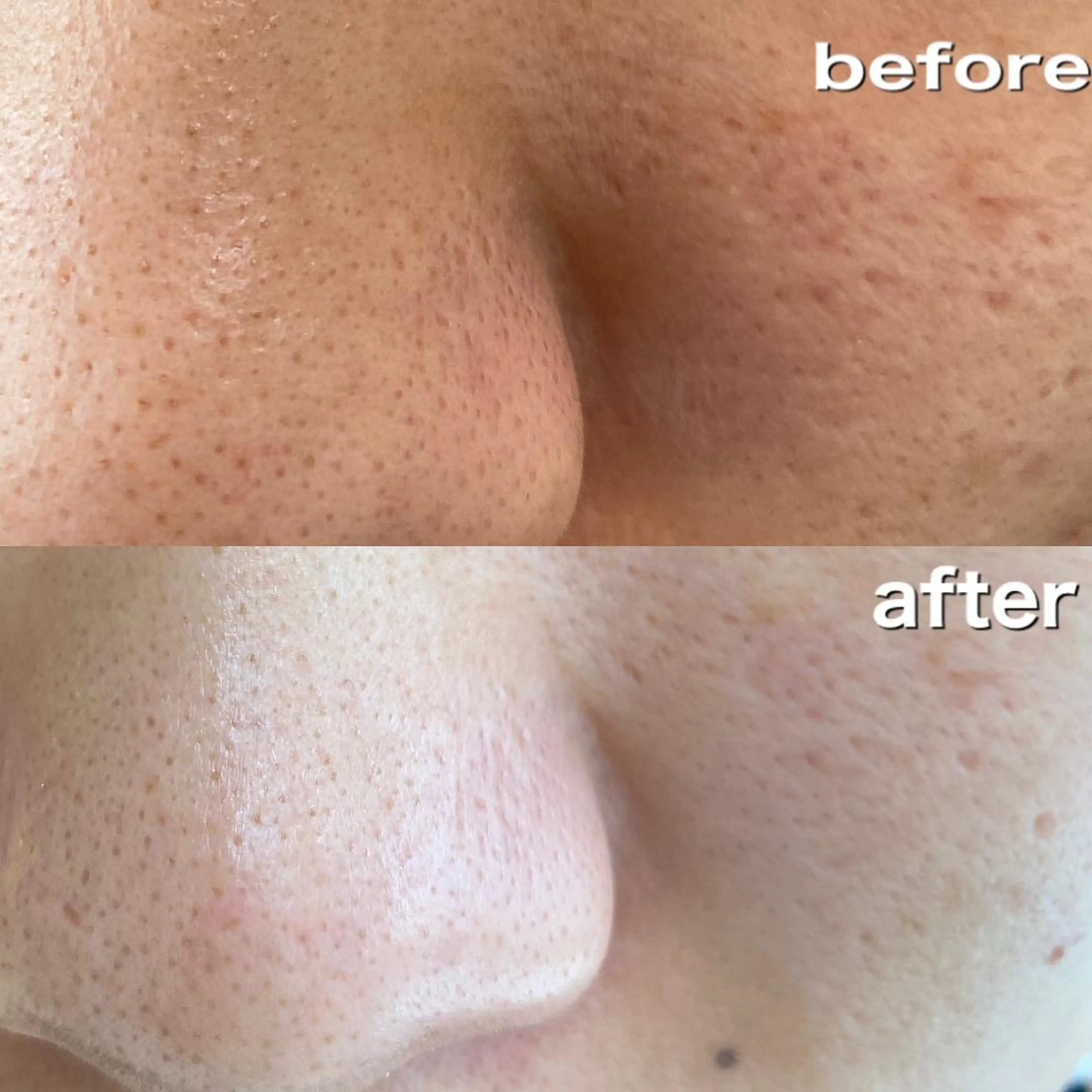 ロイヤル•セラピスト 【Tabata】のマツエク・マツパデザイン