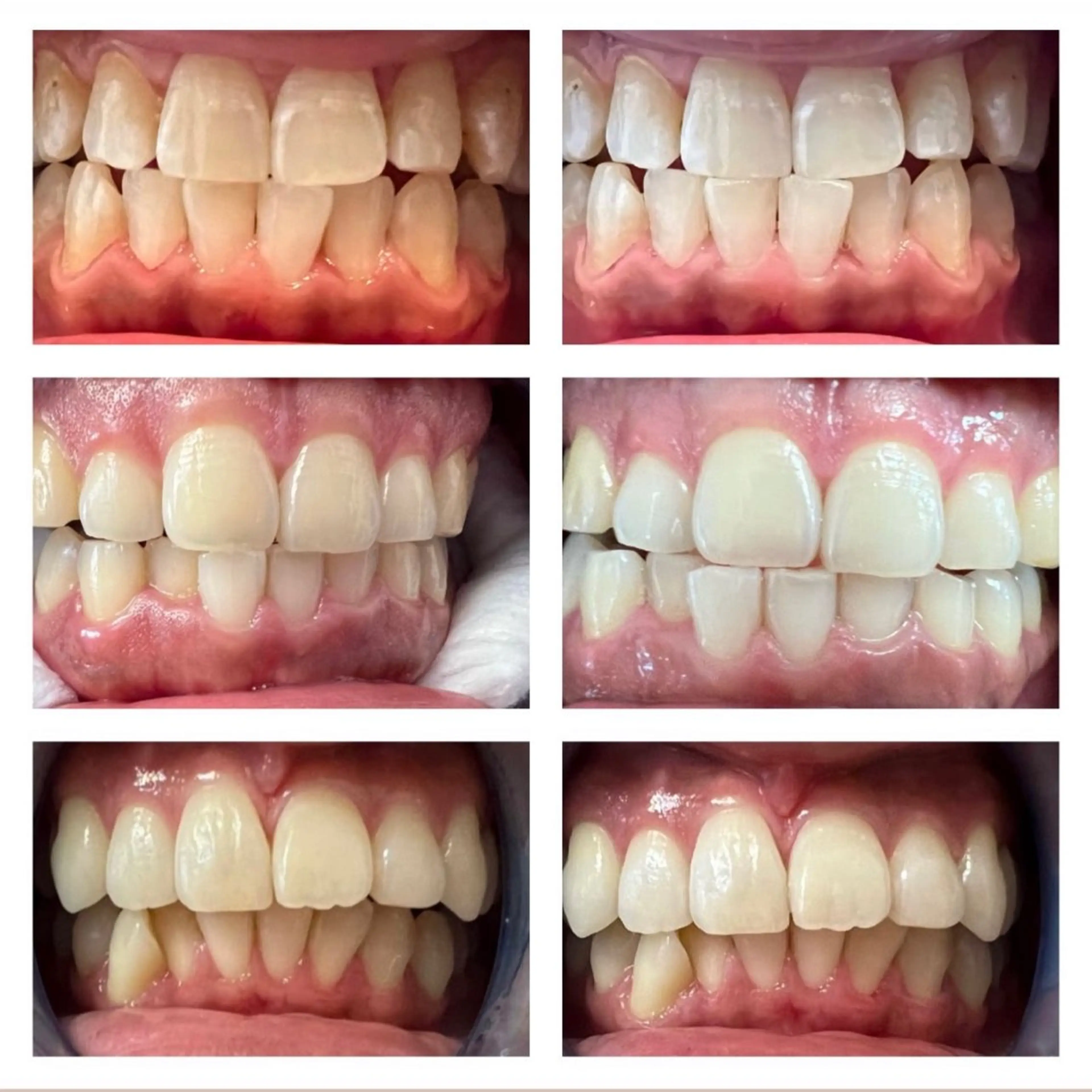 【肌質改善】 gluck豊田市美里のエステ・リラクイメージ