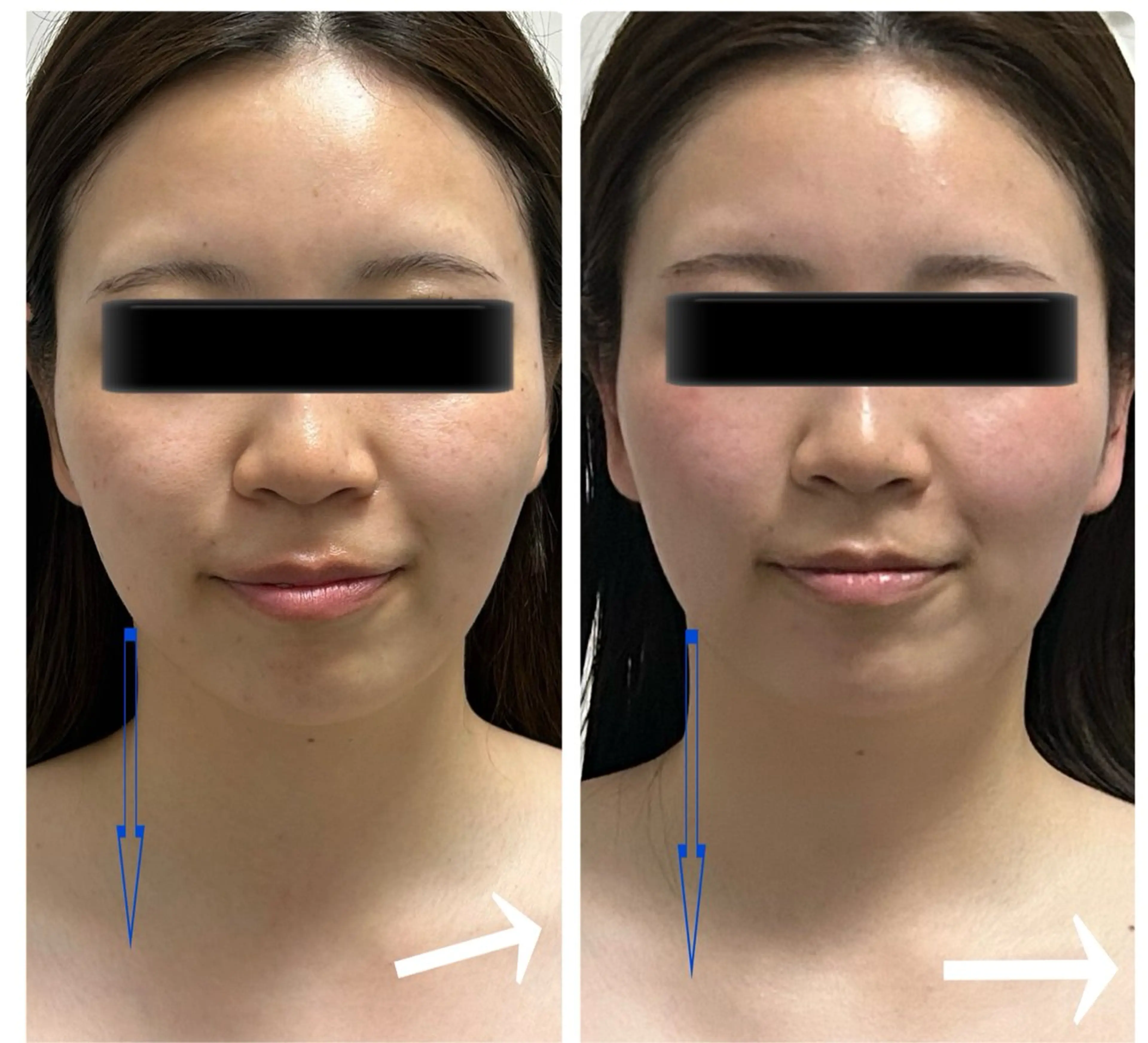 その他 esthesalon Ran所属・小顔美肌痩身サロン Ranのその他イメージ