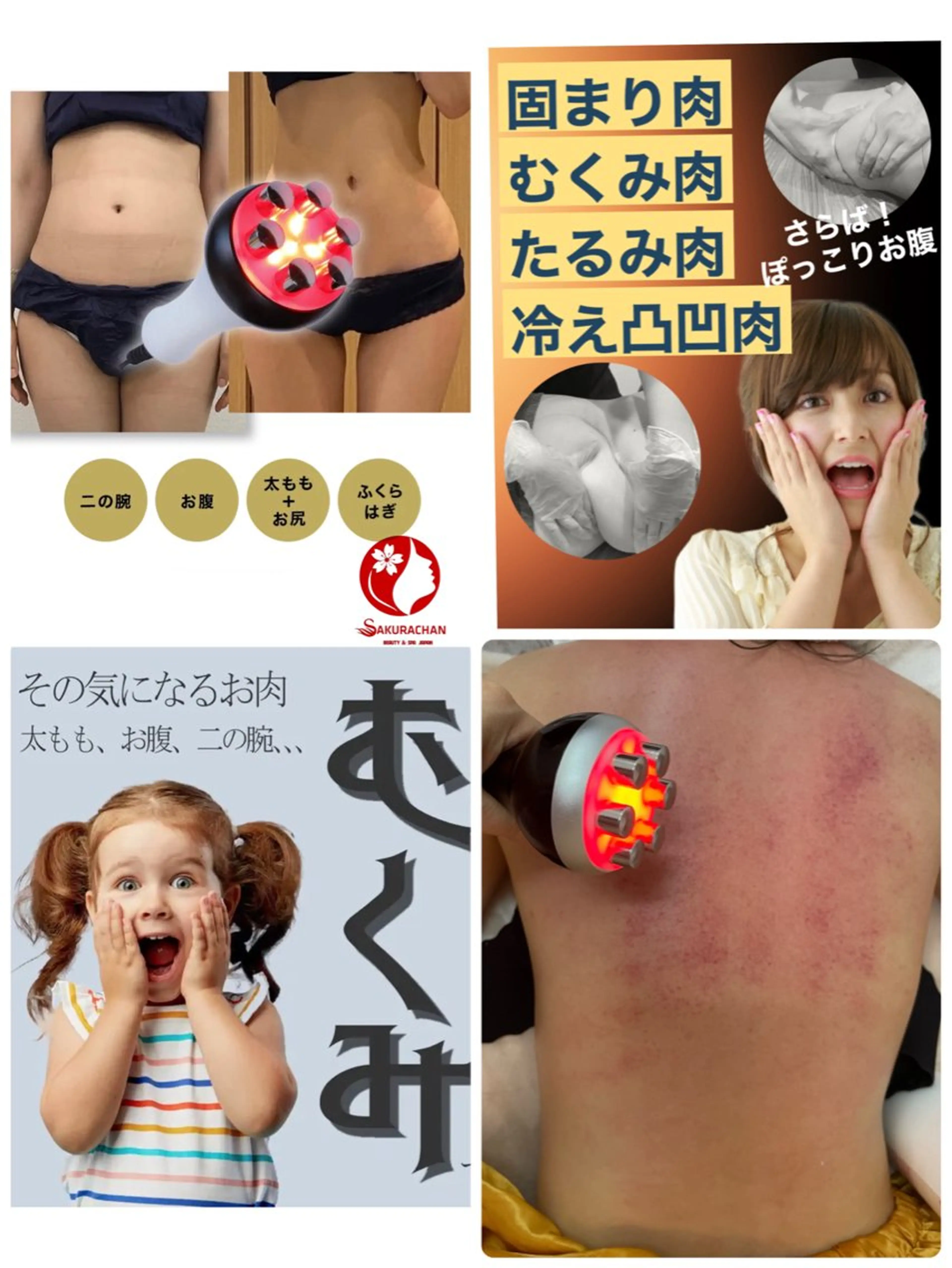 【SALE】痩身＋肩首痛み，疲れ解消】最先端キャビテーション＋ラジオ派＋吸引+ヒートマット大量発汗＋ヘッド90分の写真