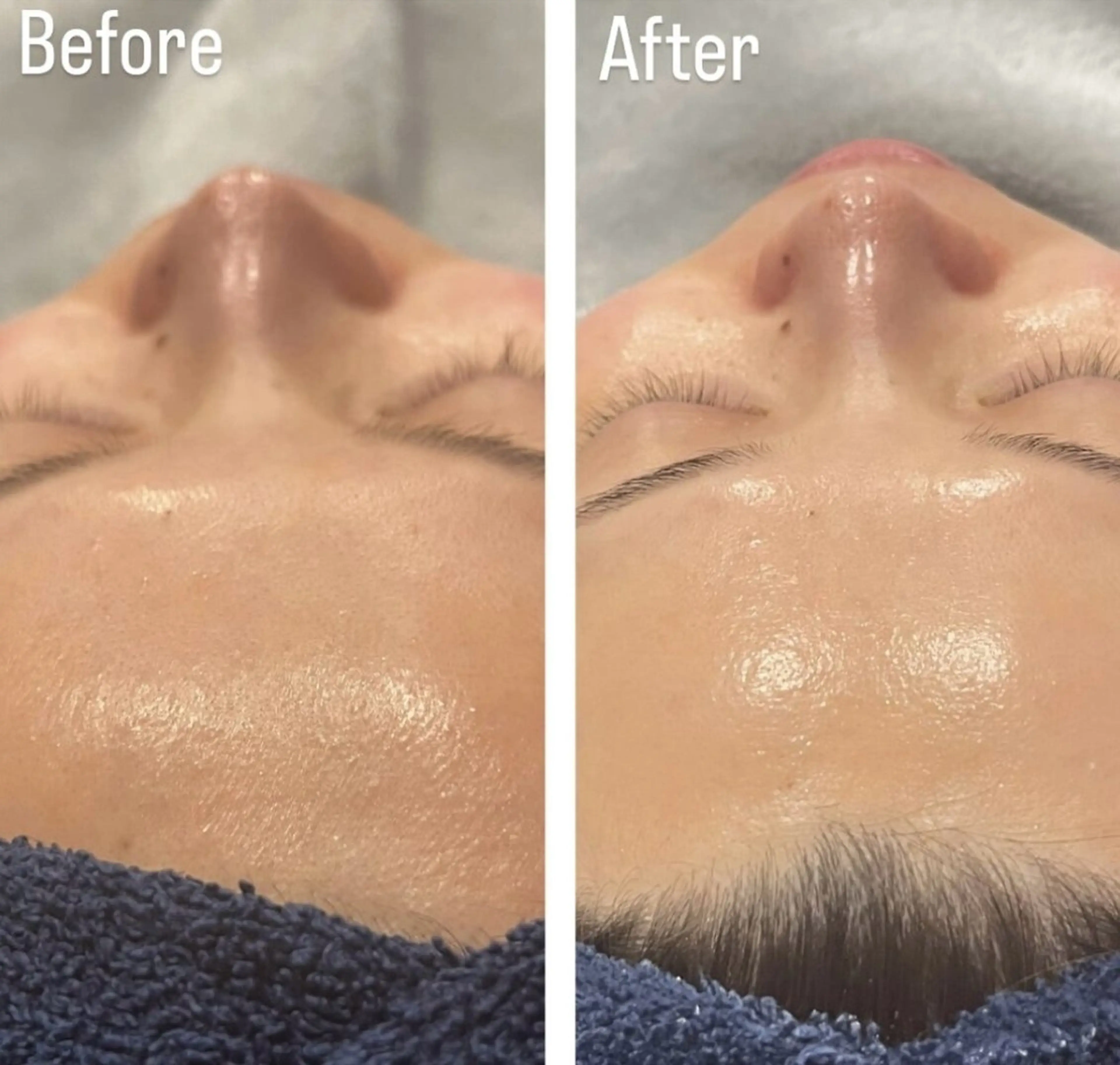 アンド ミルルのエステ・リラクイメージ