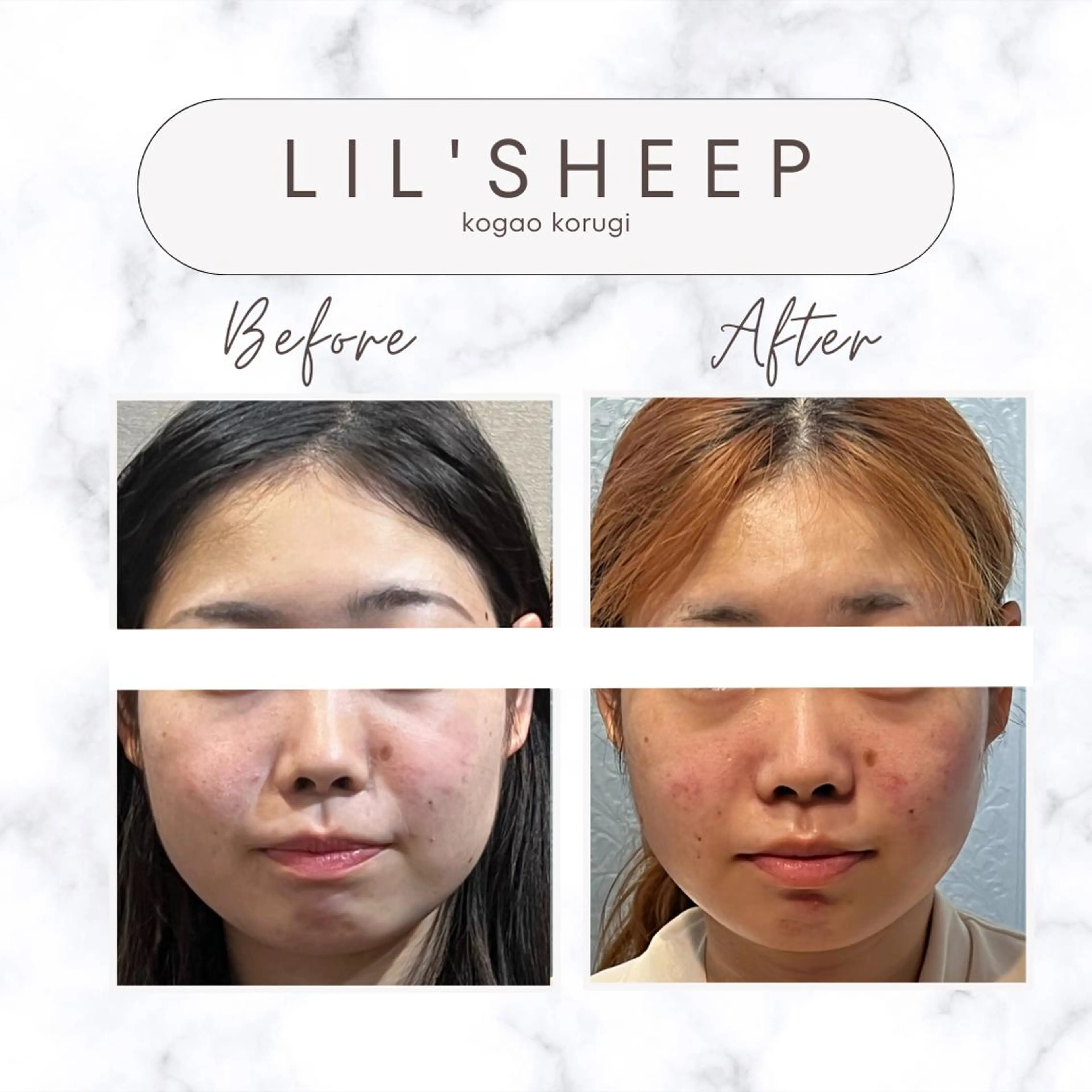 小嶋萌 今池駅徒歩2分のエステ・リラクイメージ