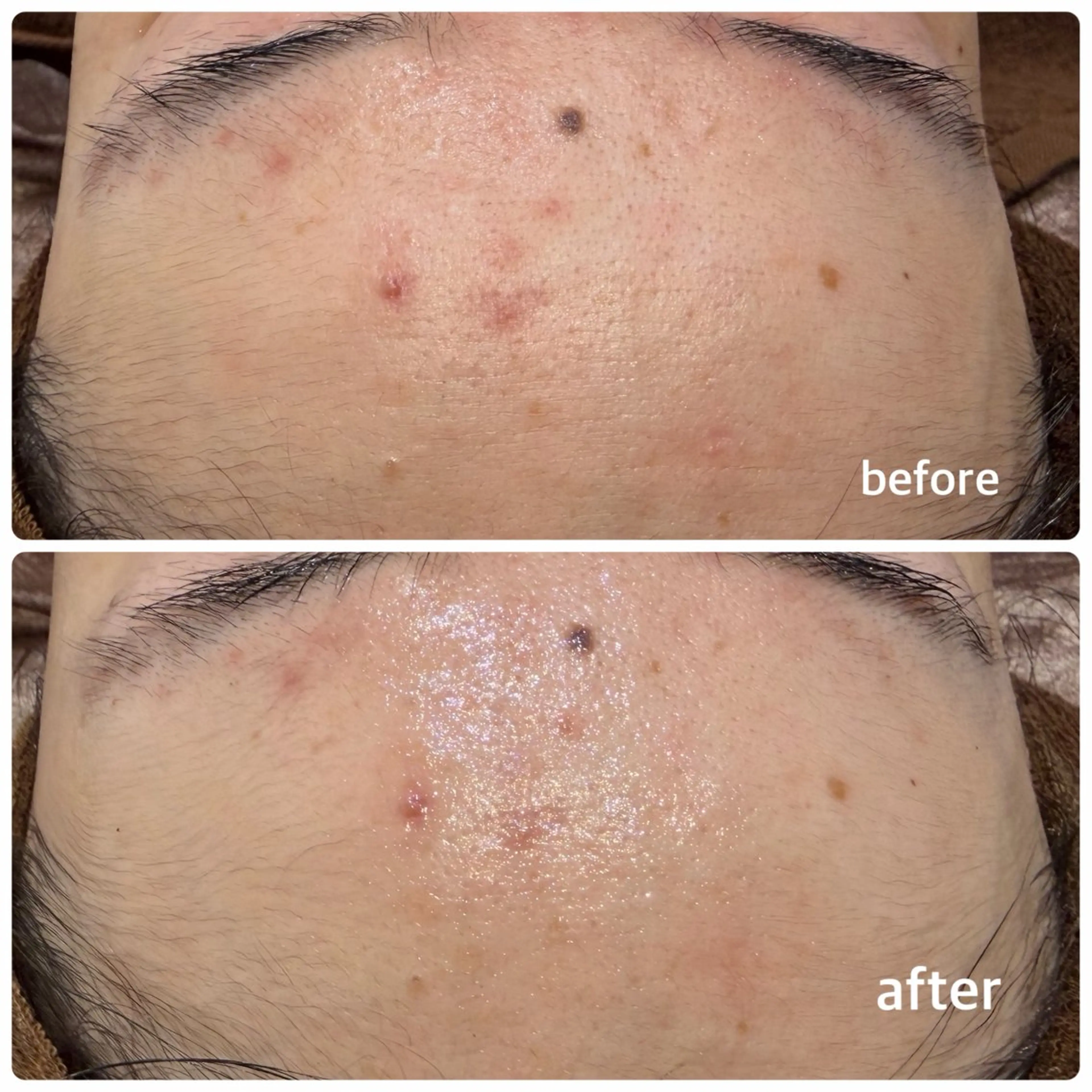 その他 今西 彩夢のエステ・リラクイメージ