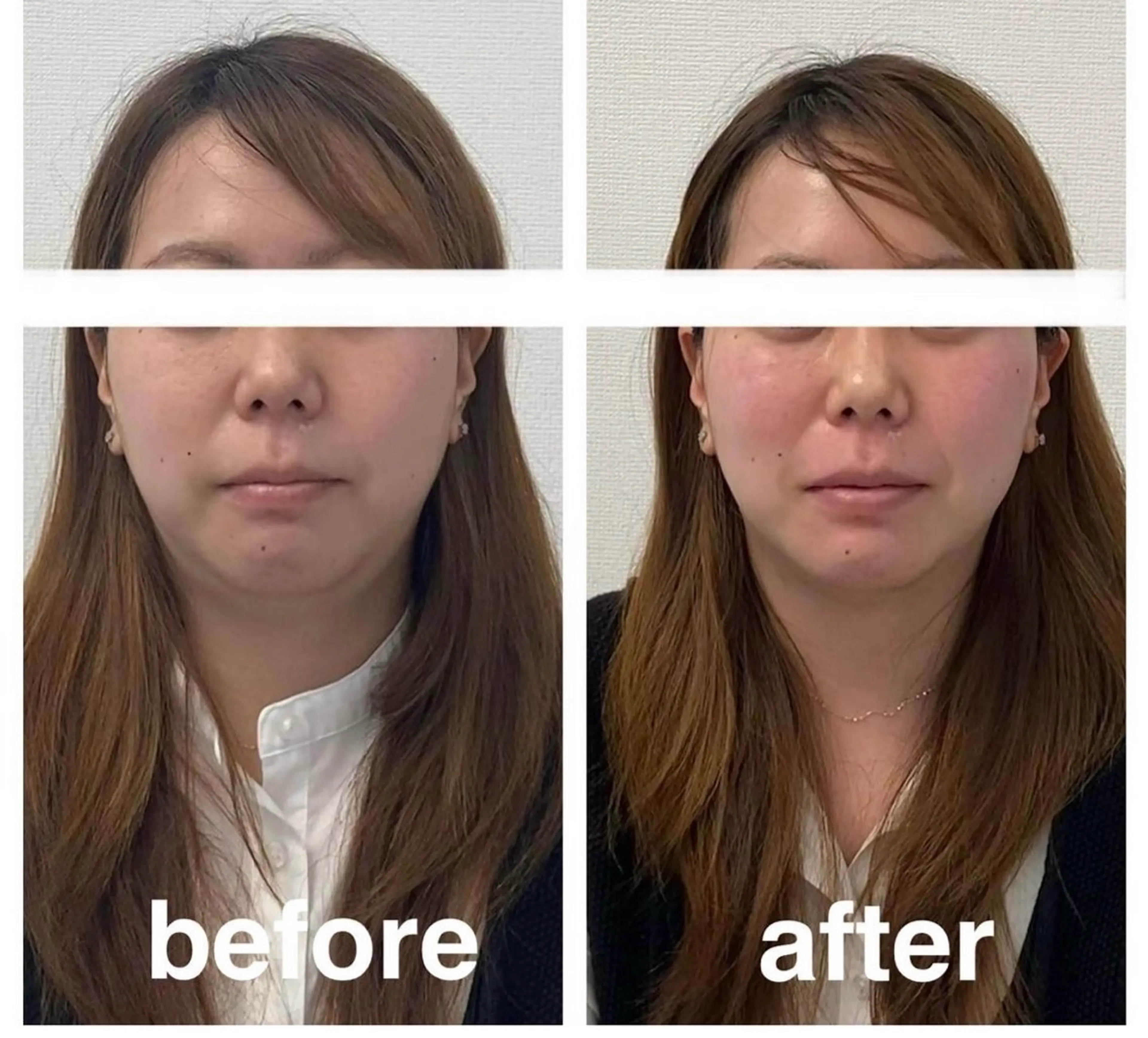 その他 小顔矯正サロンAST【アスト】所属・小顔矯正サロン AST【アスト】のその他イメージ