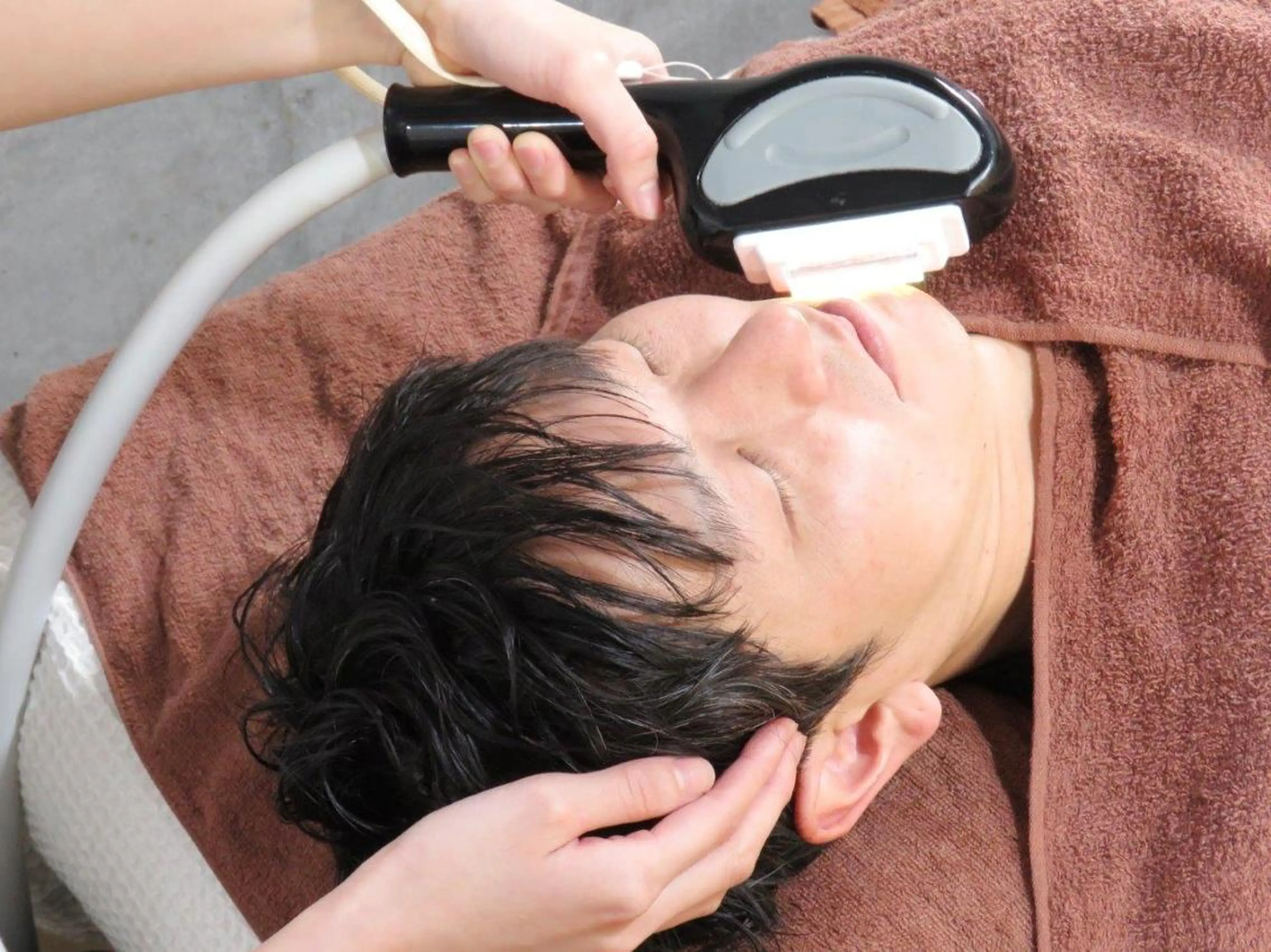 メンズヒゲ脱毛の写真