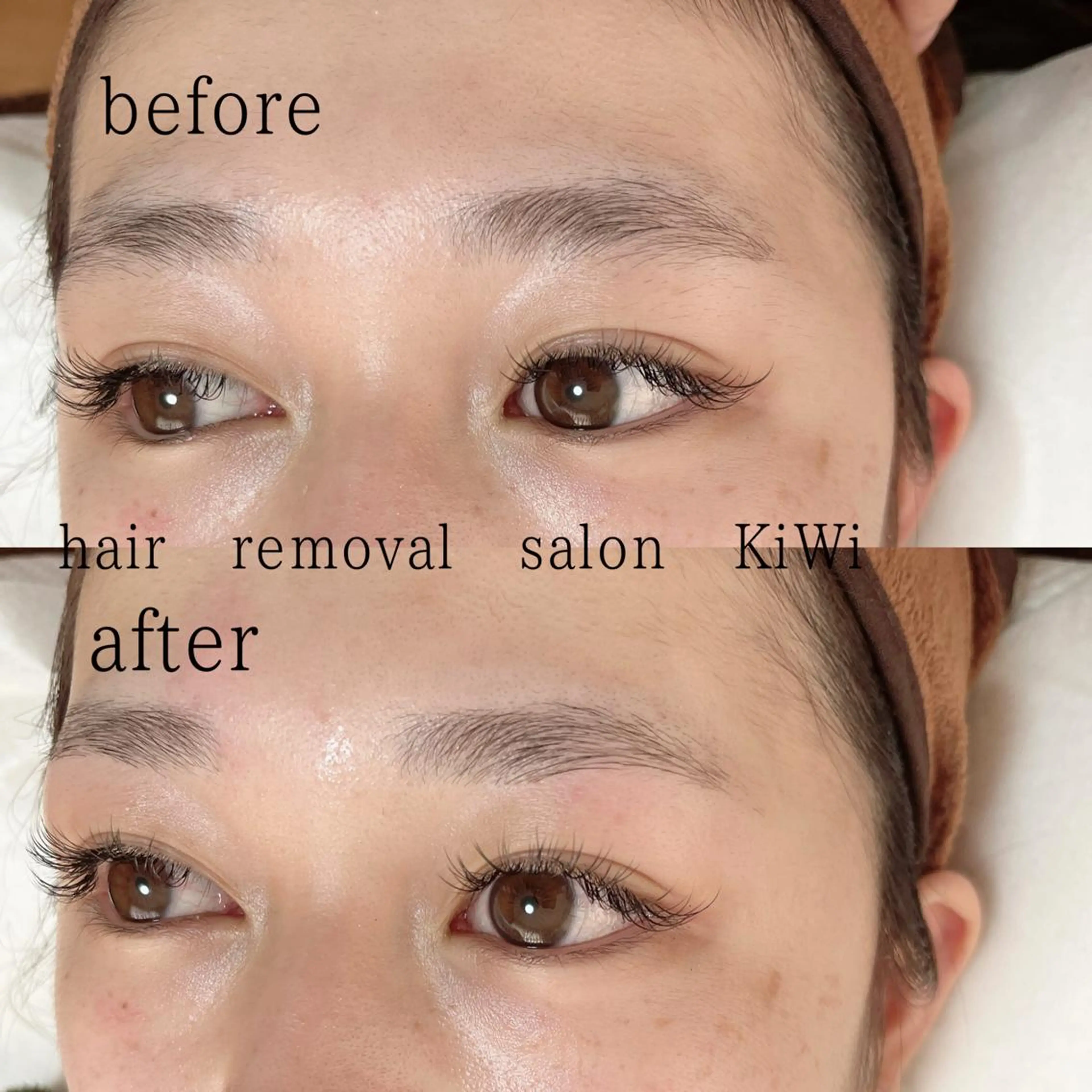 アイブロウ 脱毛サロン KiWiのエステ・リラクイメージ