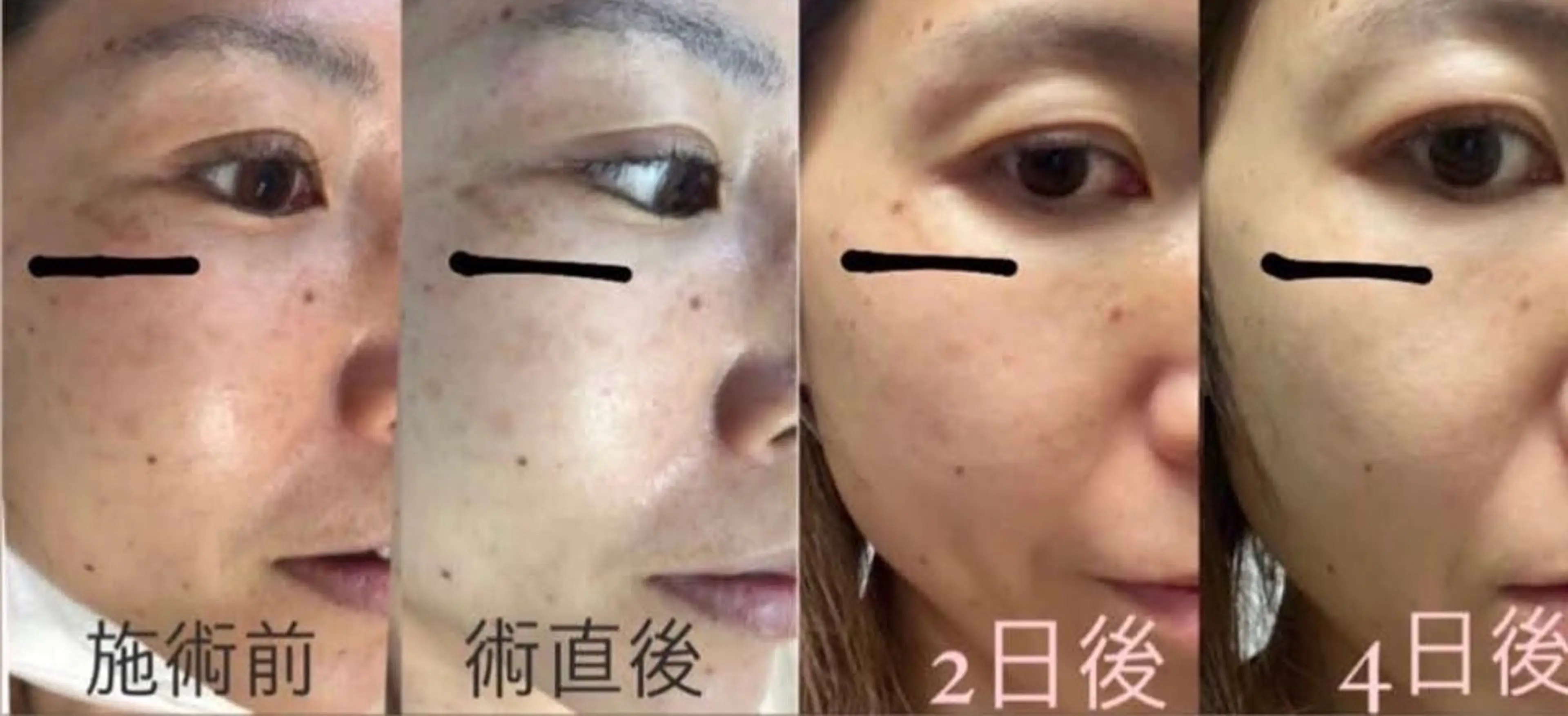 エステ 小顔/たるみ/黒ずみ除去専門サロン/SONA 大和西大寺店所属・【小顔専門看護師 サロンSONA】のエステ・リラクイメージ