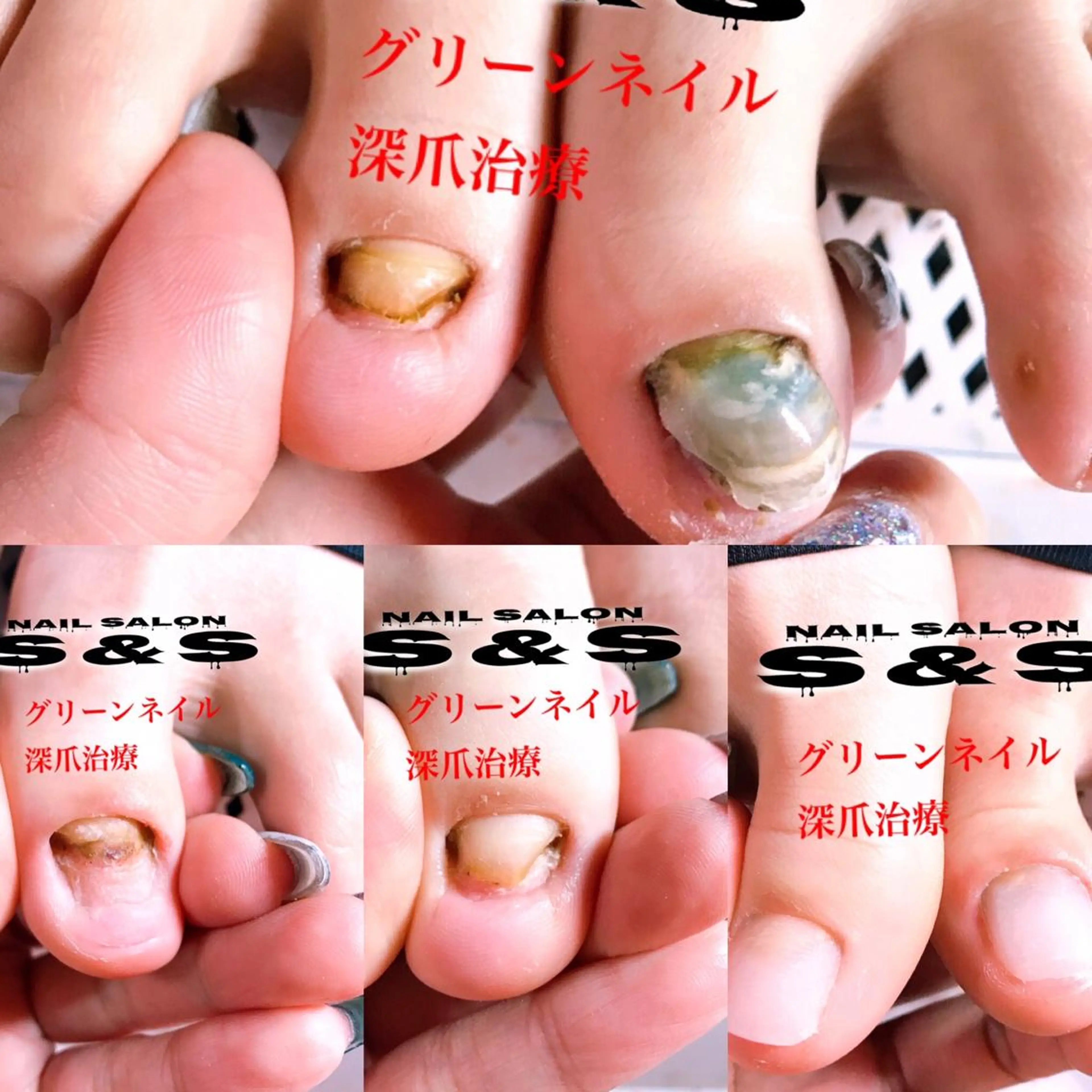 ネイル S&S 村田小百合のネイルデザイン
