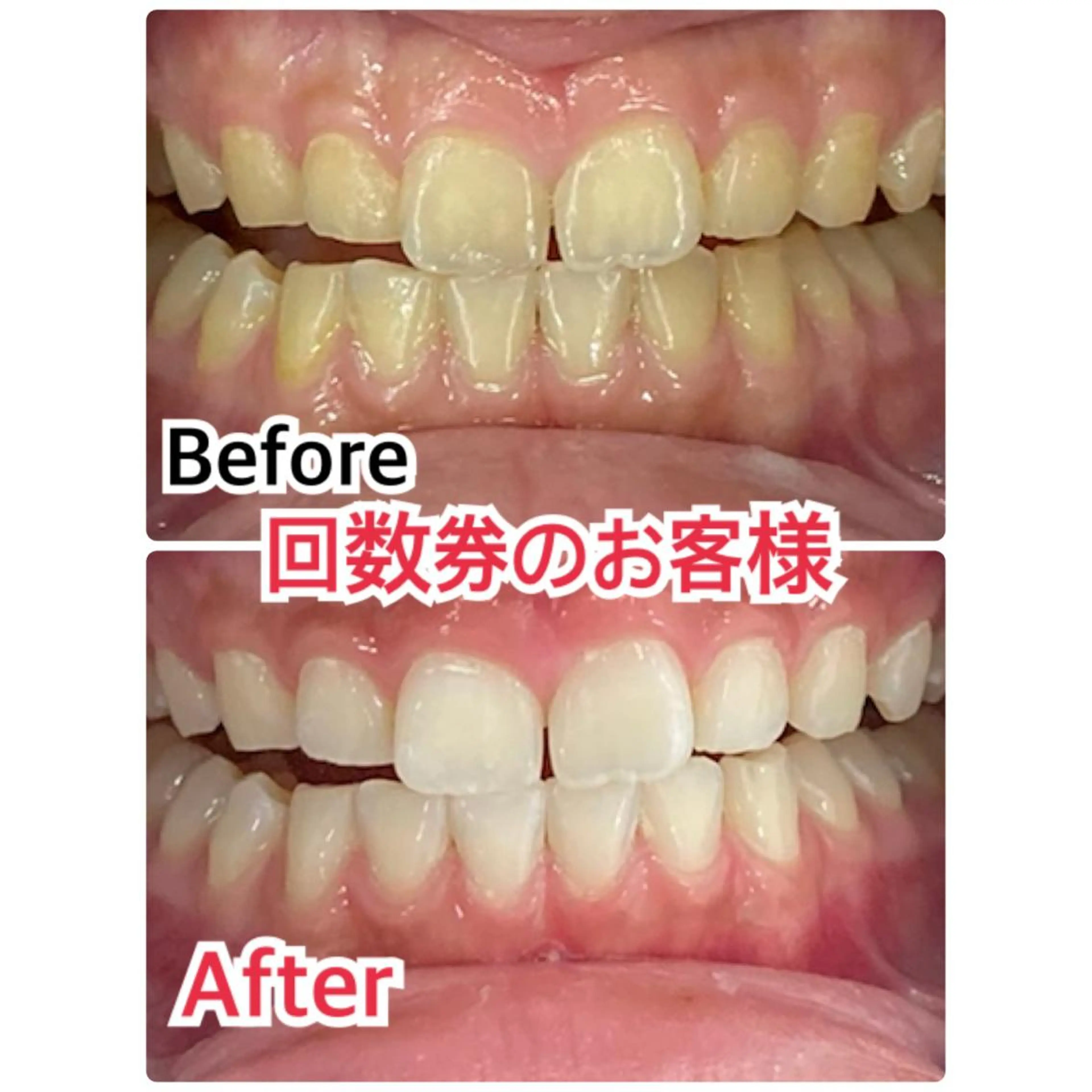 アイブロウ プラチナムビューティー柏所属・【歯科提携】柏ホワイ トニングスタイルのその他イメージ