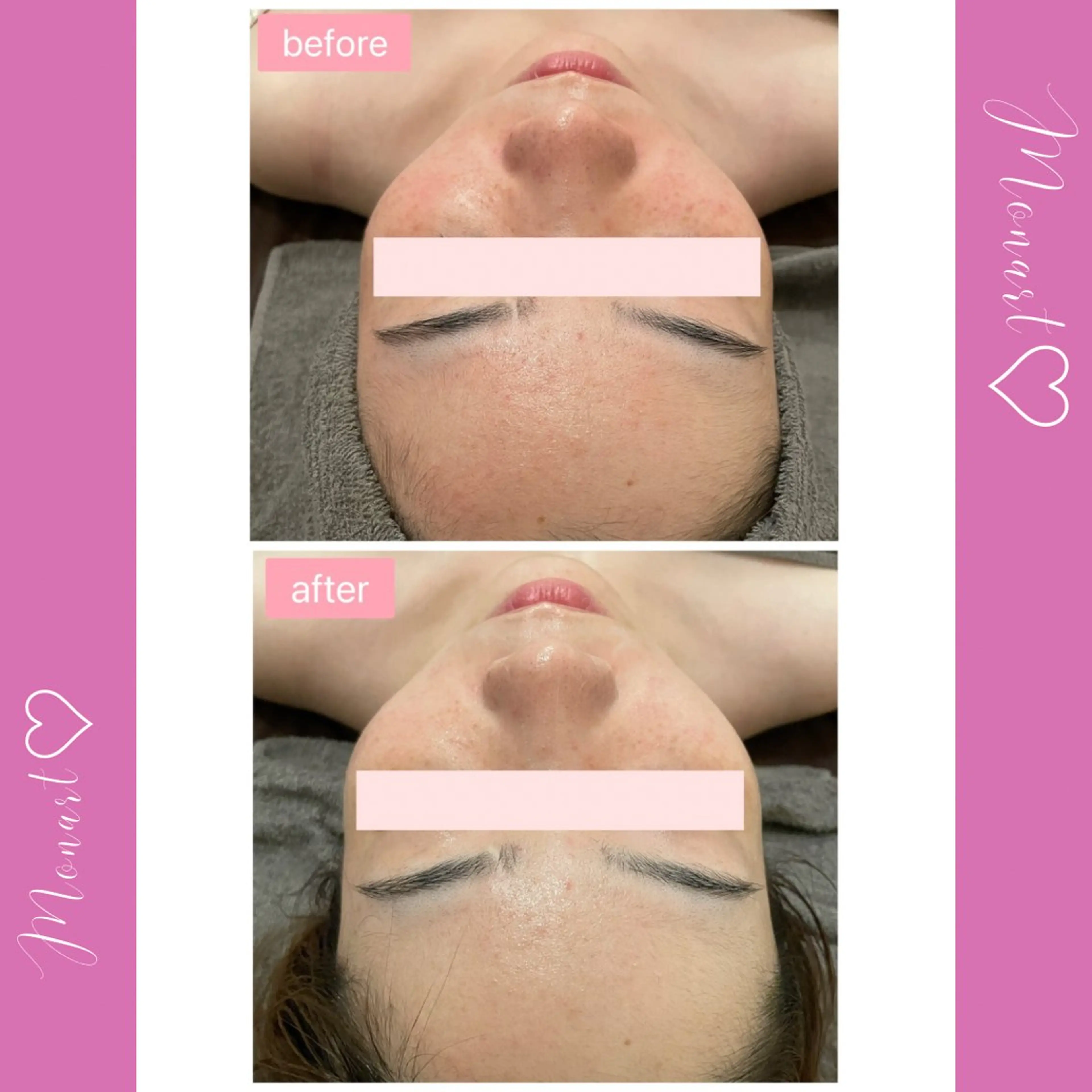 Monart -deux-のエステ・リラクイメージ