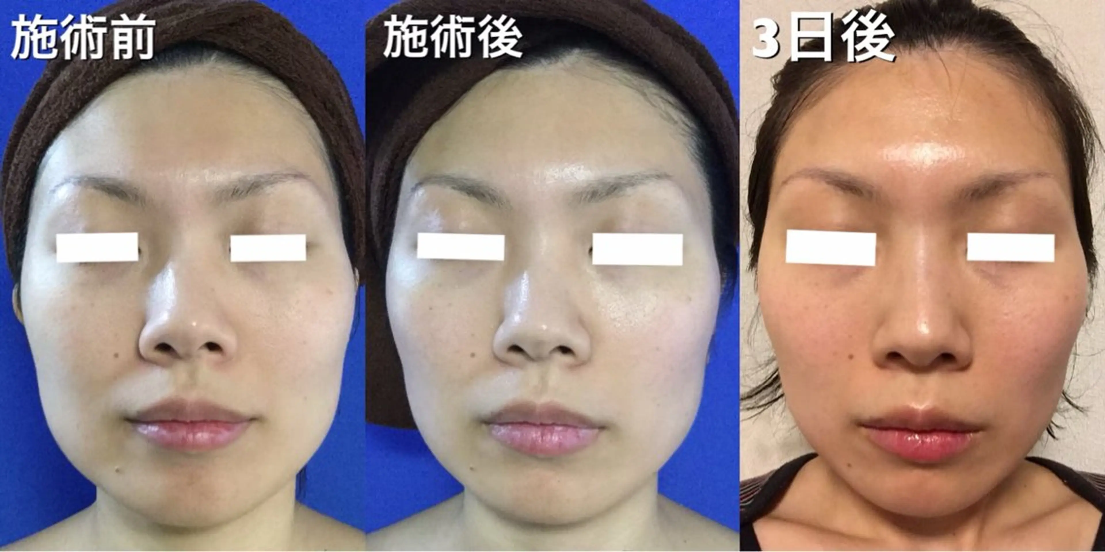 オールハンド フェイシャルのエステ・リラクイメージ