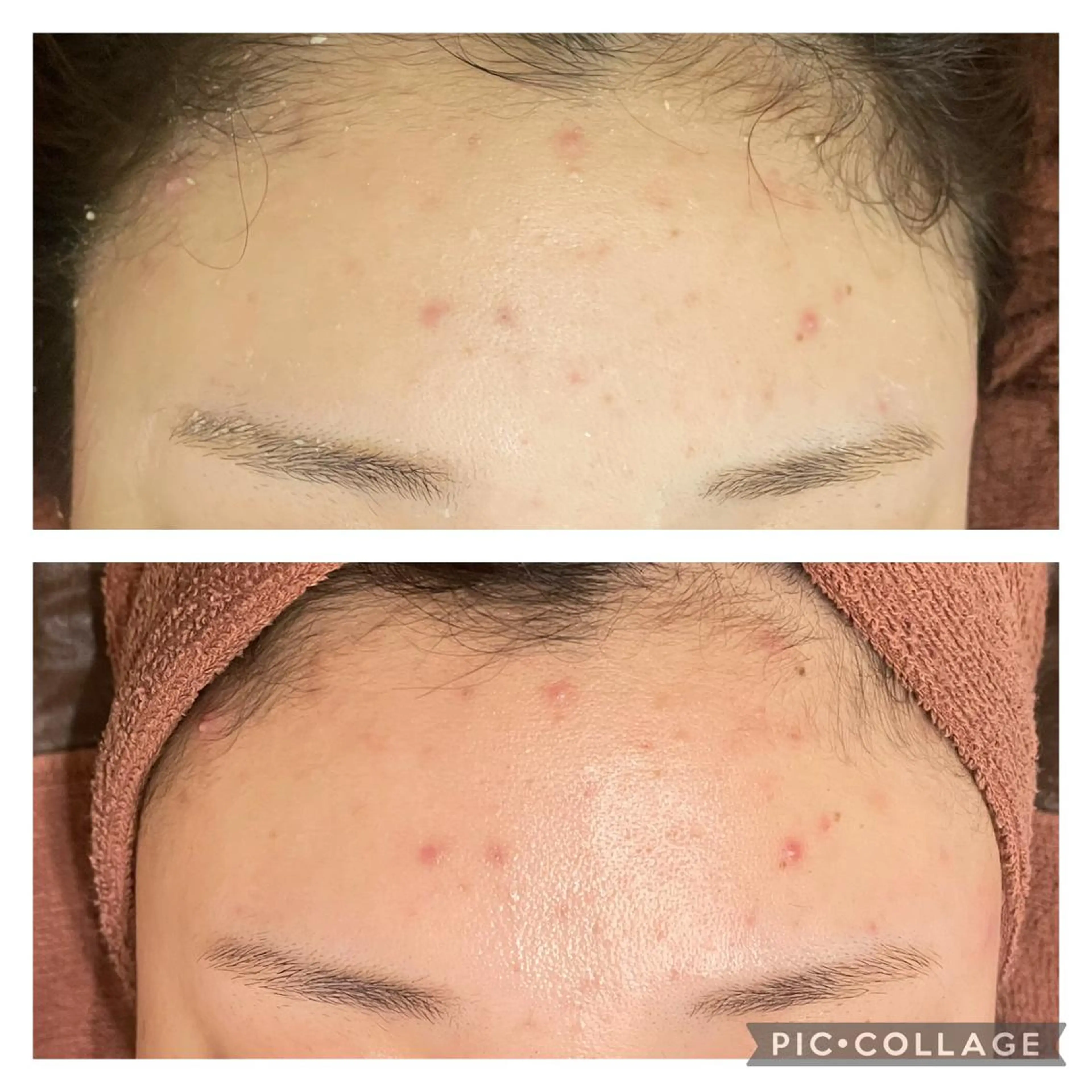 セミロング カラー パーマ ヘアアレンジ メンズ キッズ ネイル マツエク・マツパ アイブロウ エステ リラク ニキビ特化型エステ 🍓最短で肌質改善のエステ・リラクイメージ