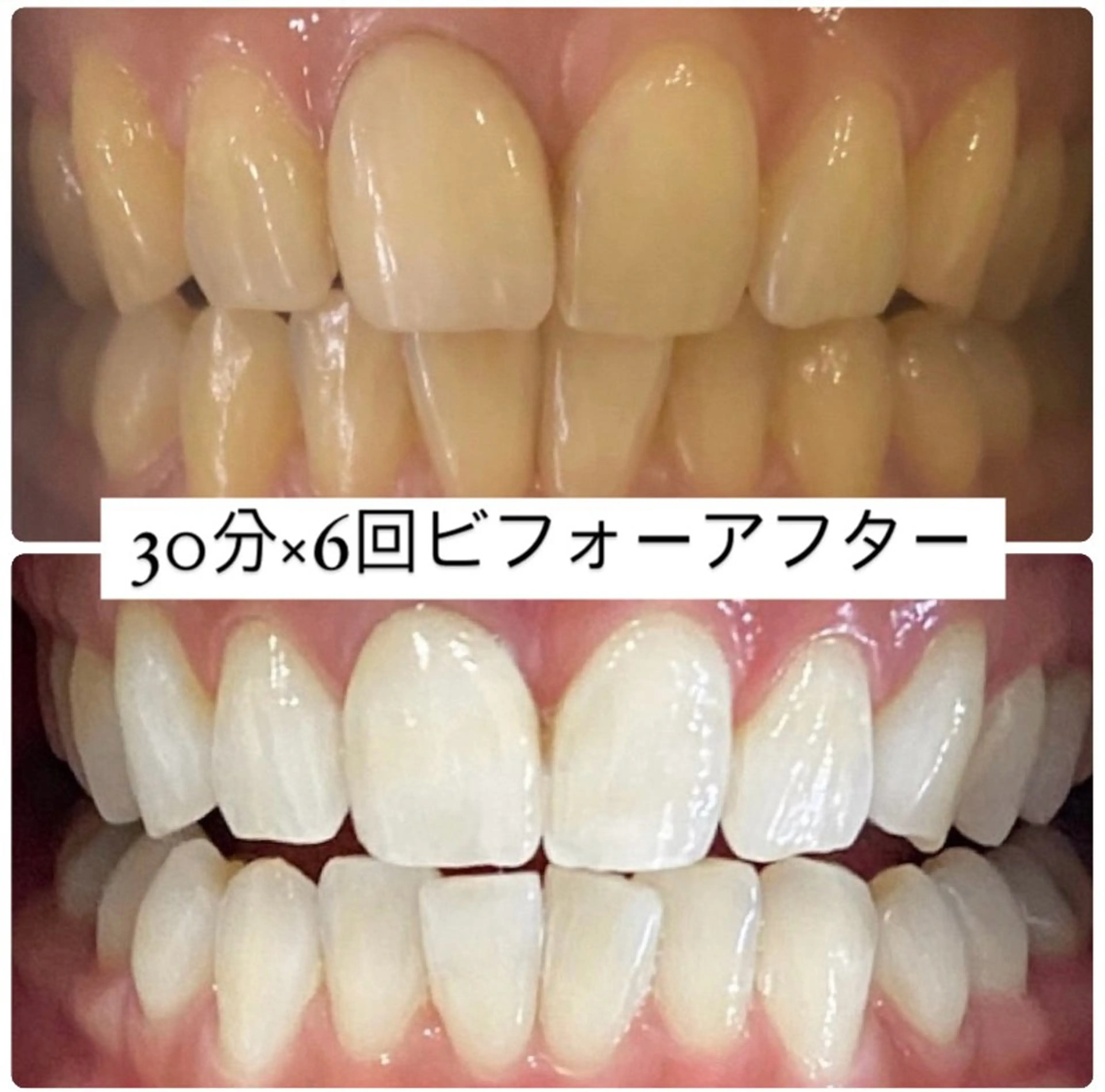 PLATINUM Beauty 横浜店所属・ホワイトニングルーム 横浜店のその他イメージ