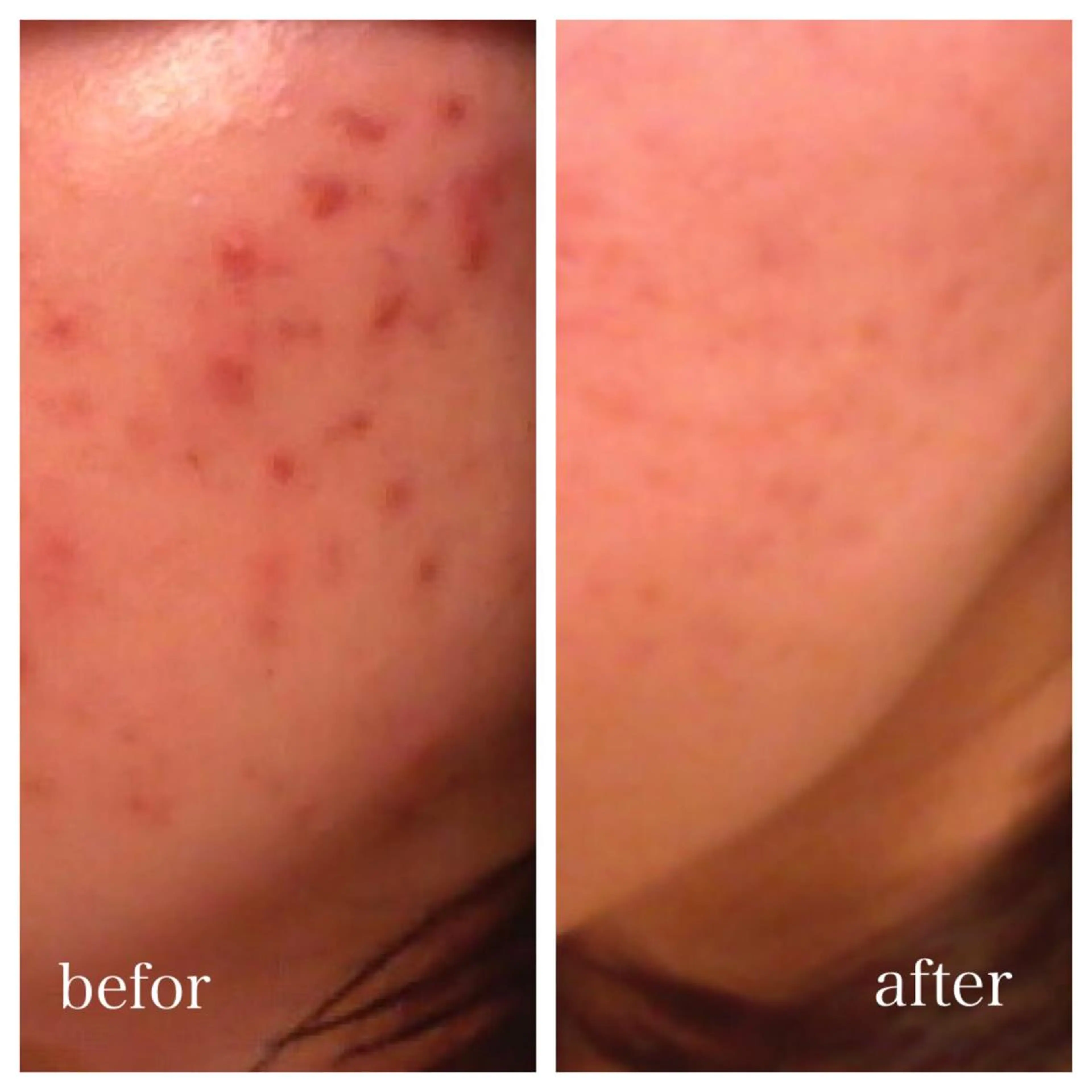 ショート ニキビ跡専門サロン Ａｉｎａのエステ・リラクイメージ