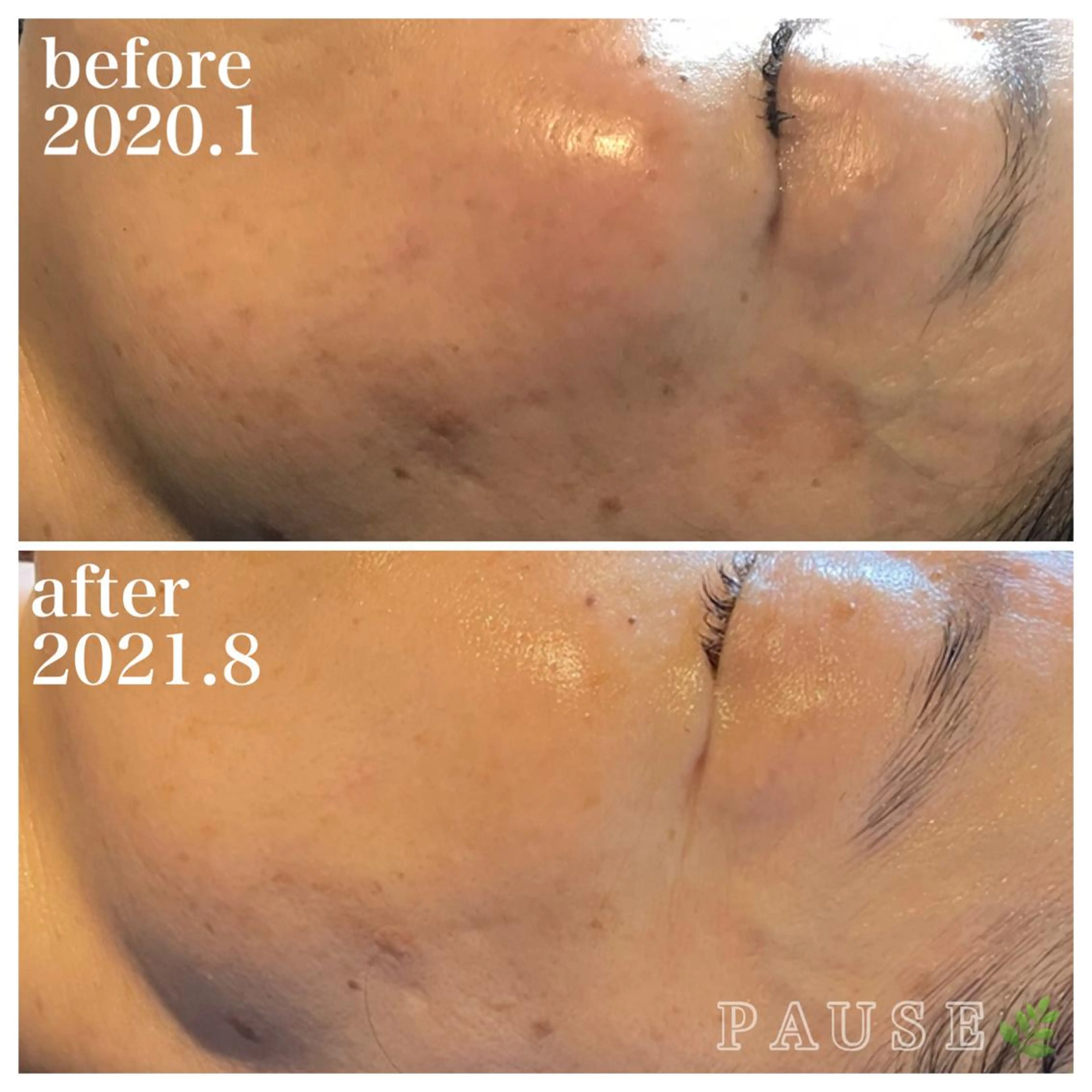 エステ 浜野 恵美のエステ・リラクイメージ