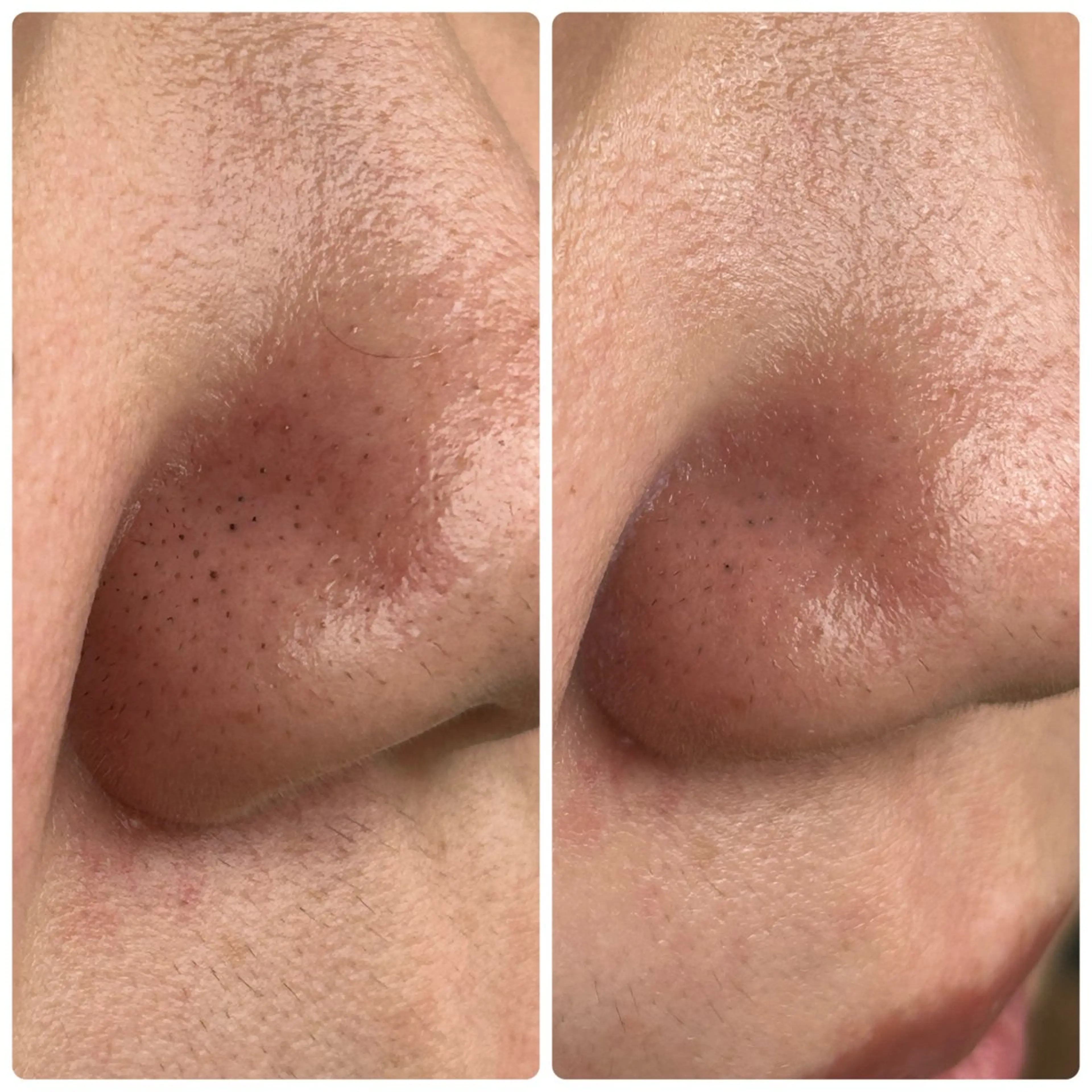 エステ MAXKELLY大阪店所属・___shi nailのネイルデザイン