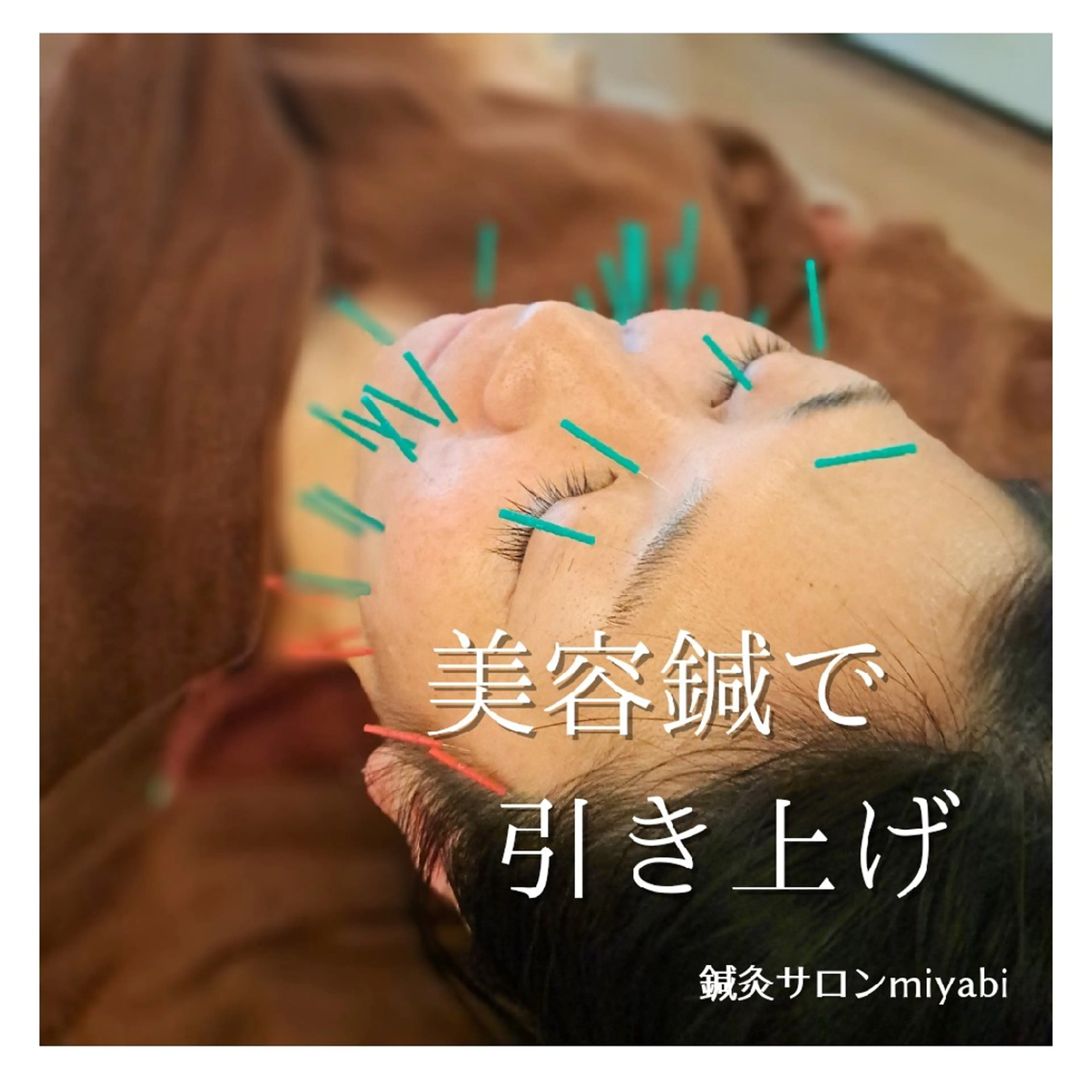 👑当店人気No.1👑背中から緩めて引き上げる✨背中マッサージ+造顔リンパ&小顔美容鍼 90分の写真