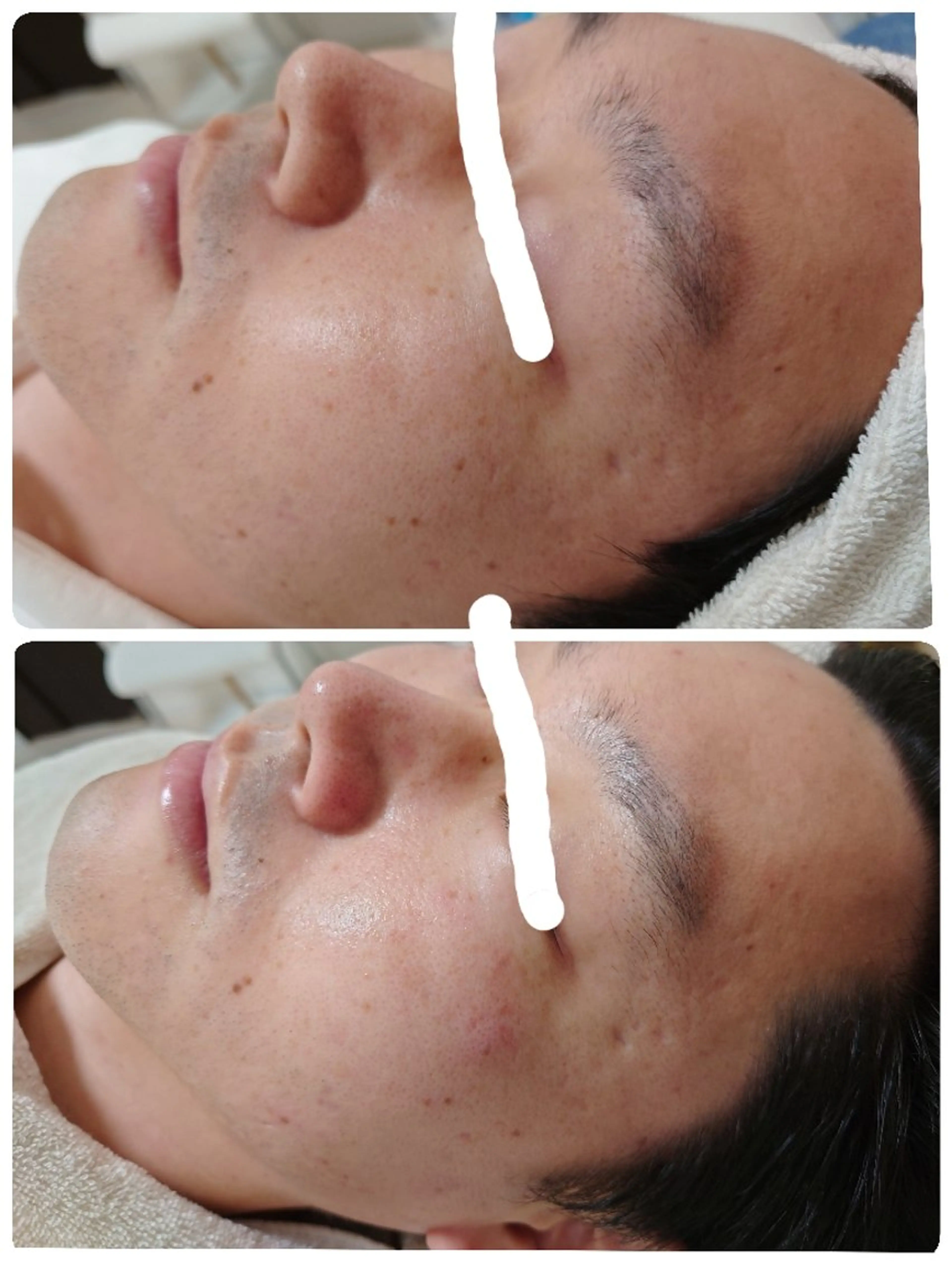 エステ Abe Yukaのエステ・リラクイメージ