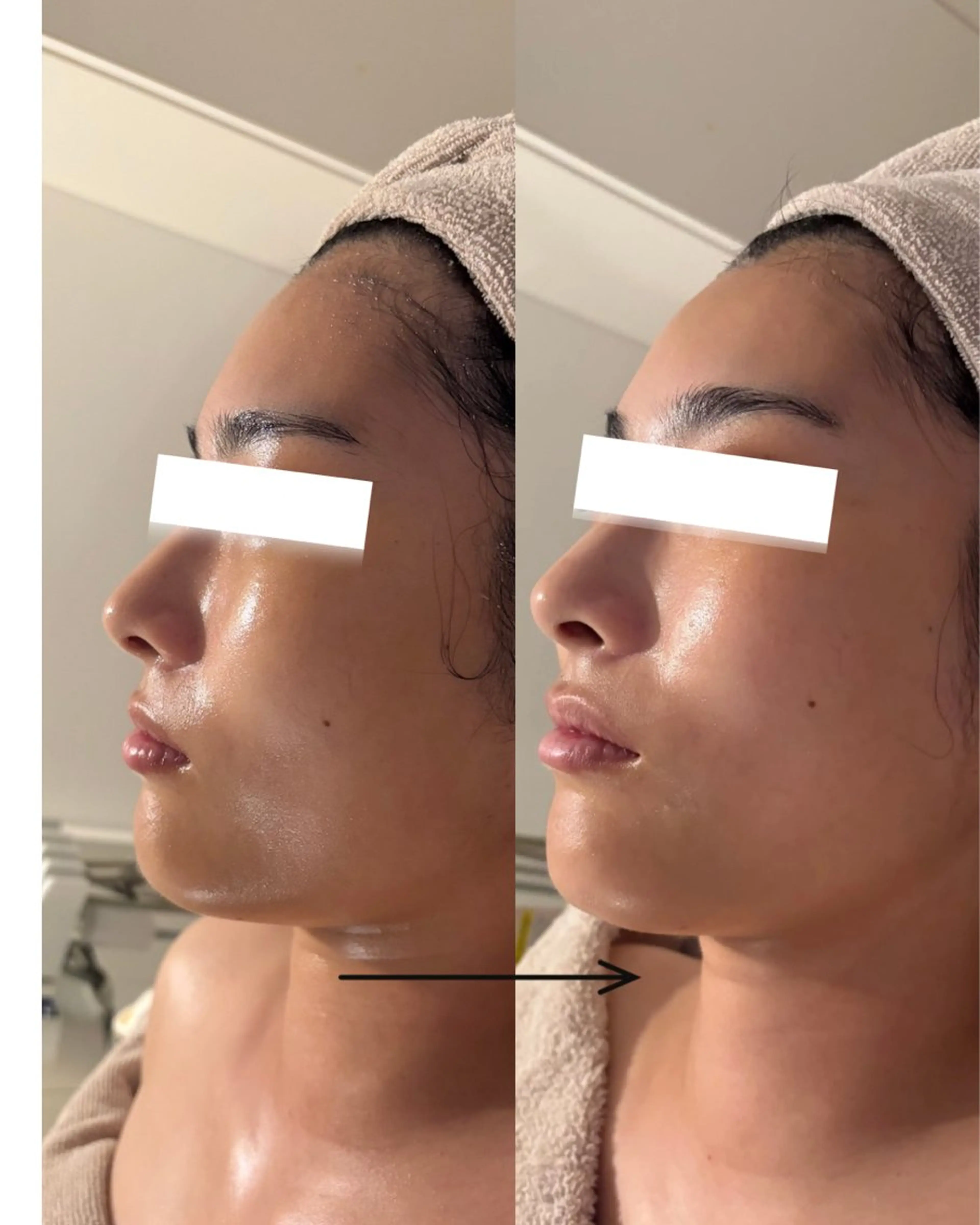 POLA THE BEAUTY 天王寺店所属・UEDA | POLA 天王寺のエステ・リラクイメージ