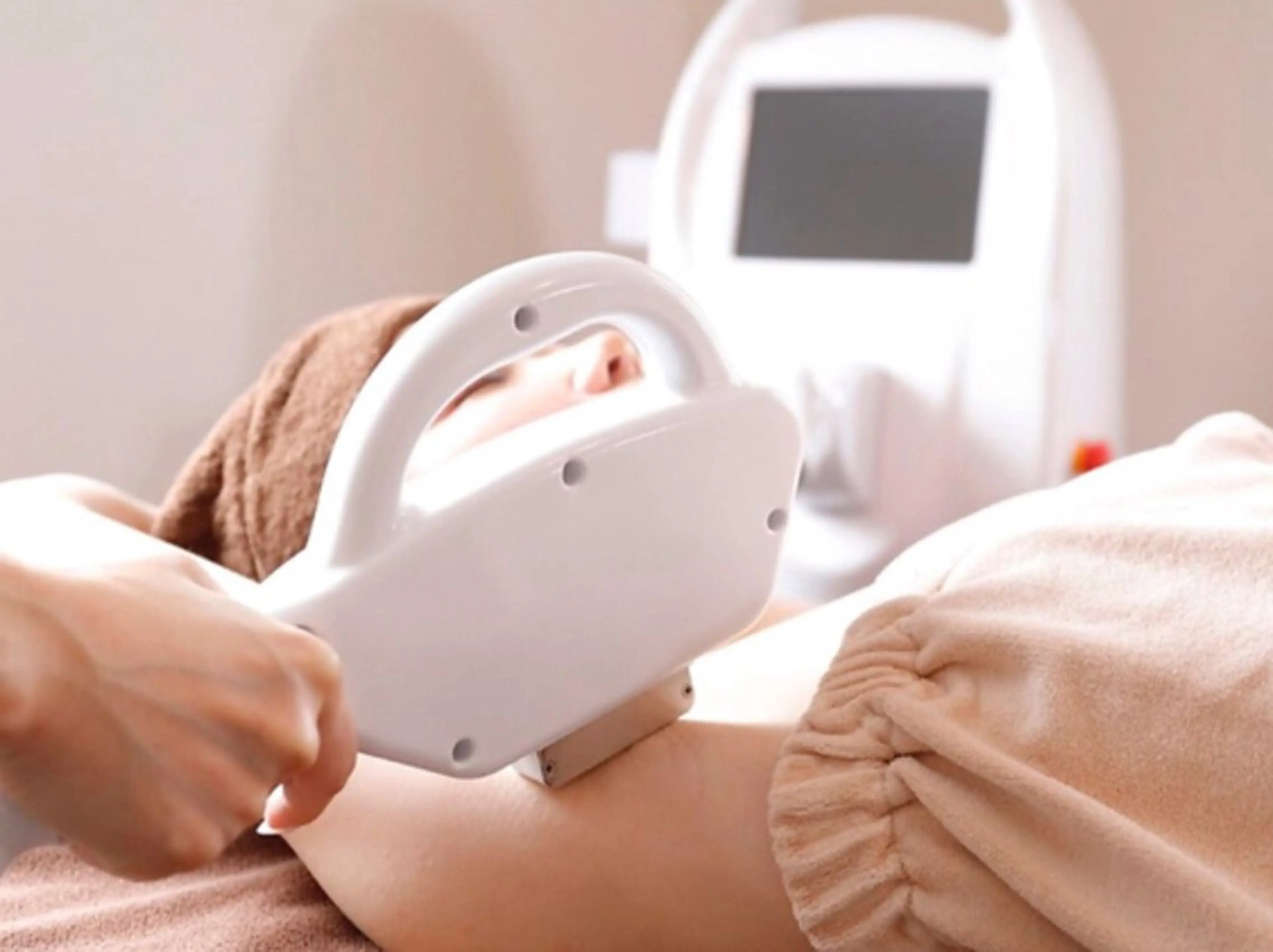 全身脱毛（顔・vio込） ¥10,000 次回予約で2回目以降も¥10,000（都度払い）の写真