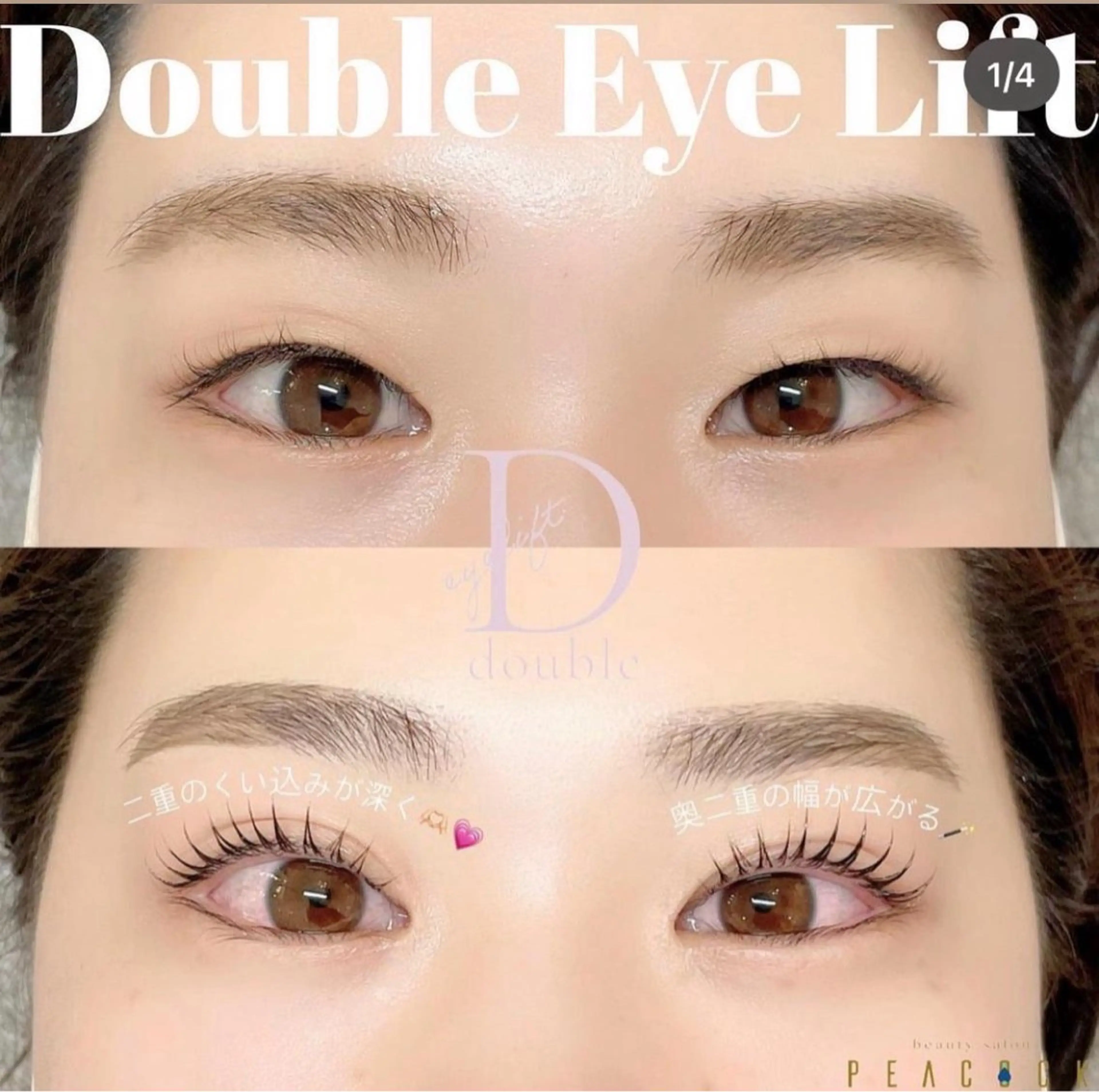 【先着5名限定】ダブルアイリフト（マッサージ、まつ毛パーマ）の写真