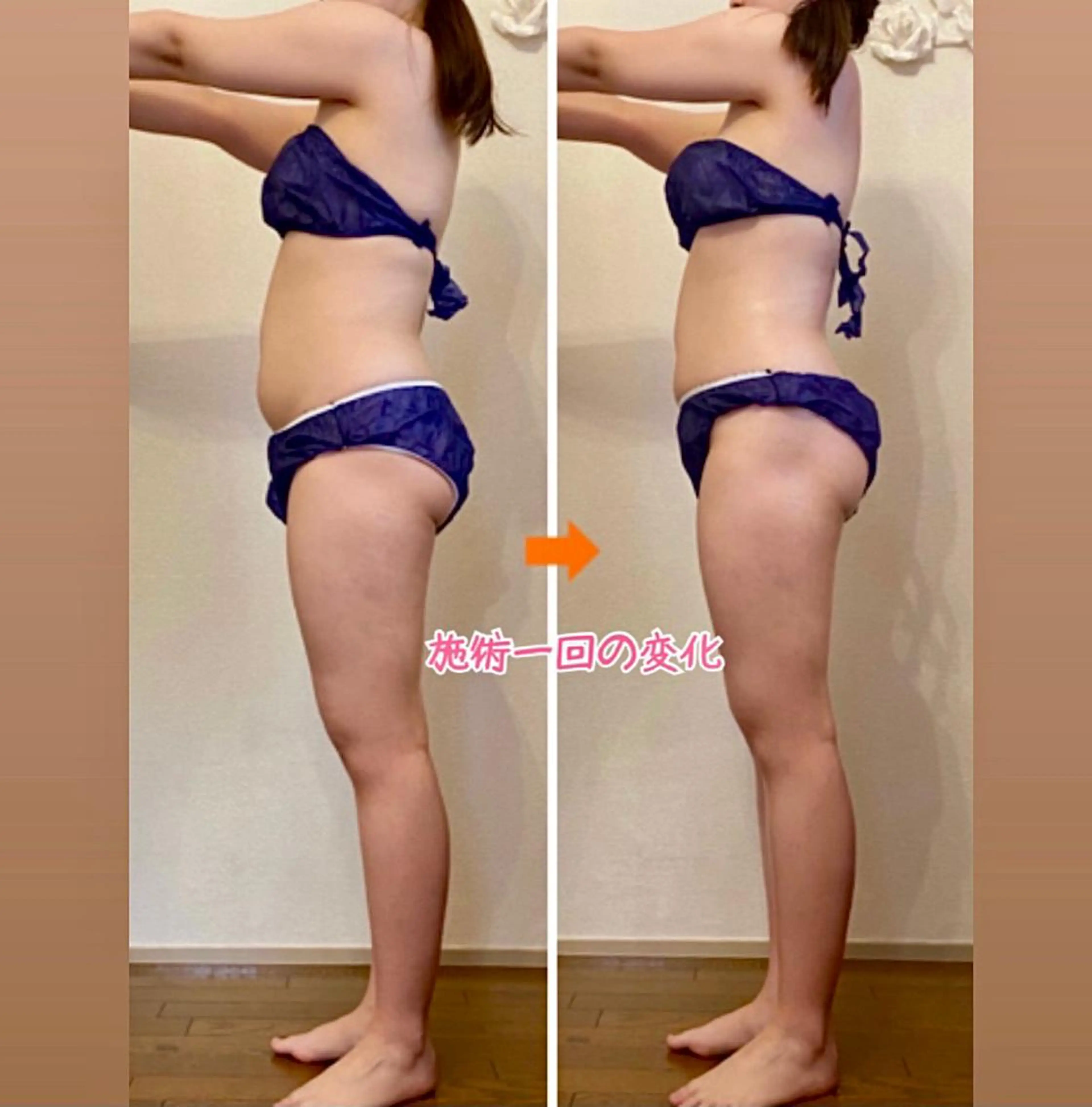 ショート カラー パーマ ヘアアレンジ メンズ キッズ ネイル マツエク・マツパ マットネイル 赤色 エステ リラク ‍痩身＆ボディ 結果出し🌟丹野のエステ・リラクイメージ