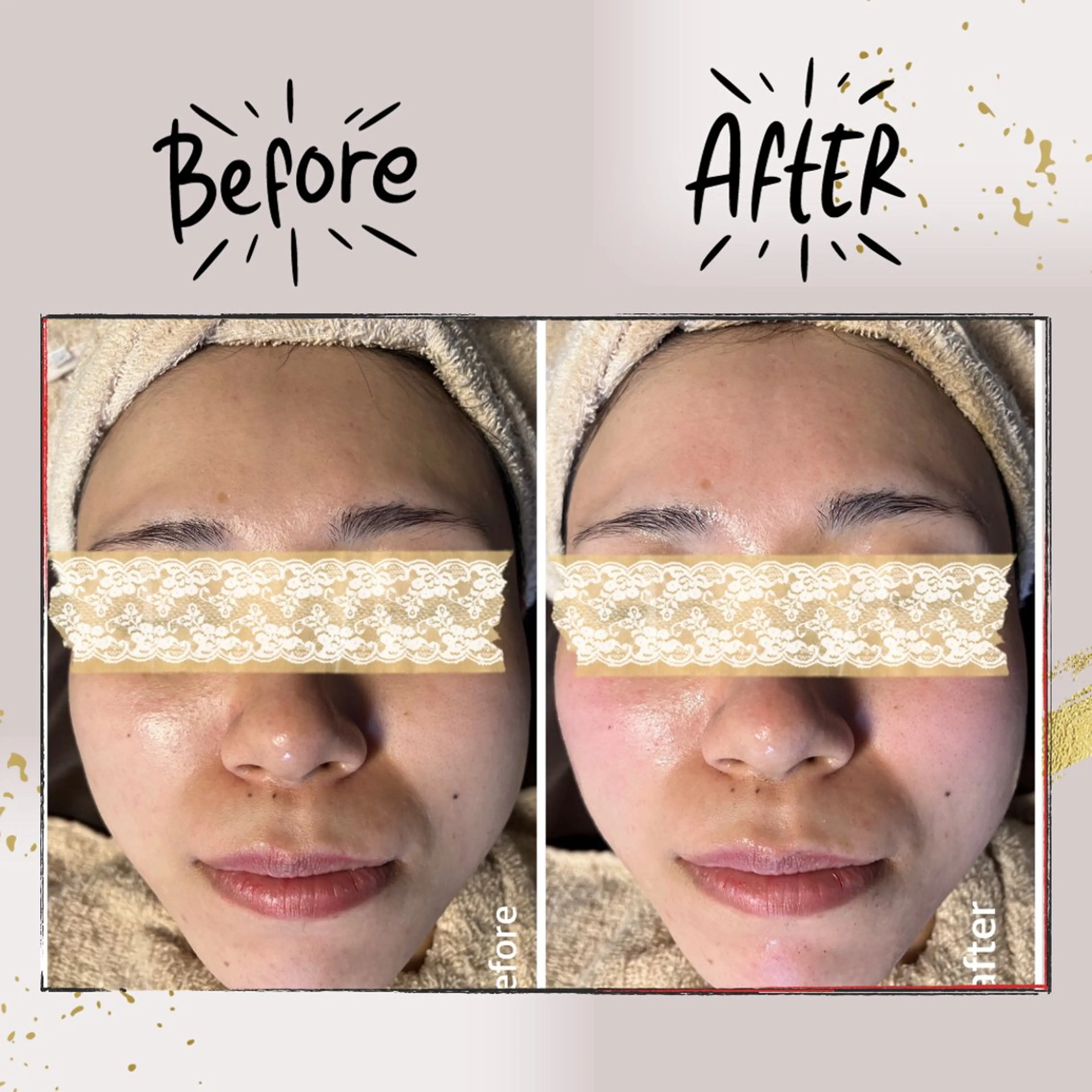 エステ リラク ピーリング専門店 Belluteのエステ・リラクイメージ