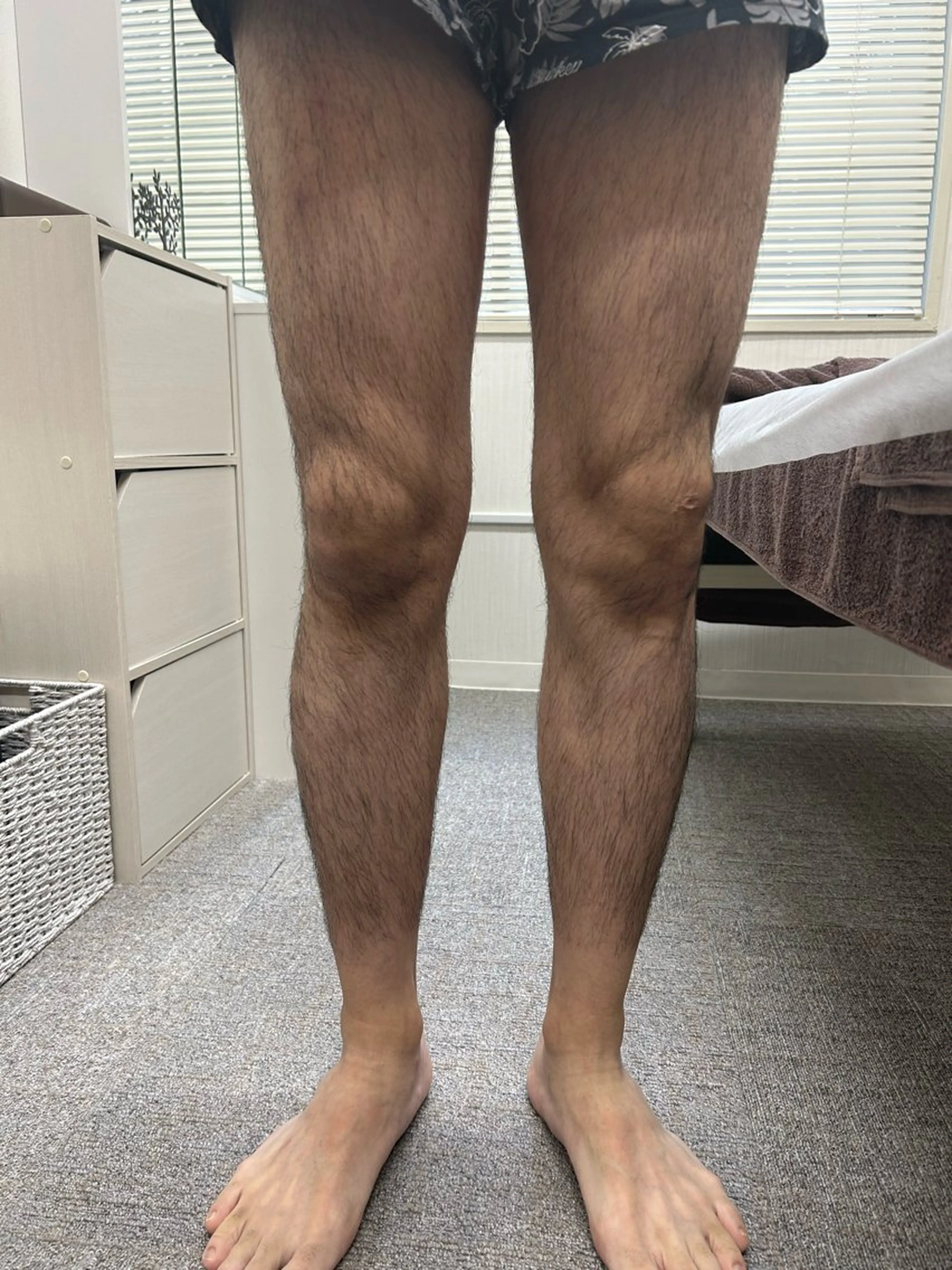 メンズ 脱毛 脱毛サロン BRIDGE橋本のエステ・リラクイメージ