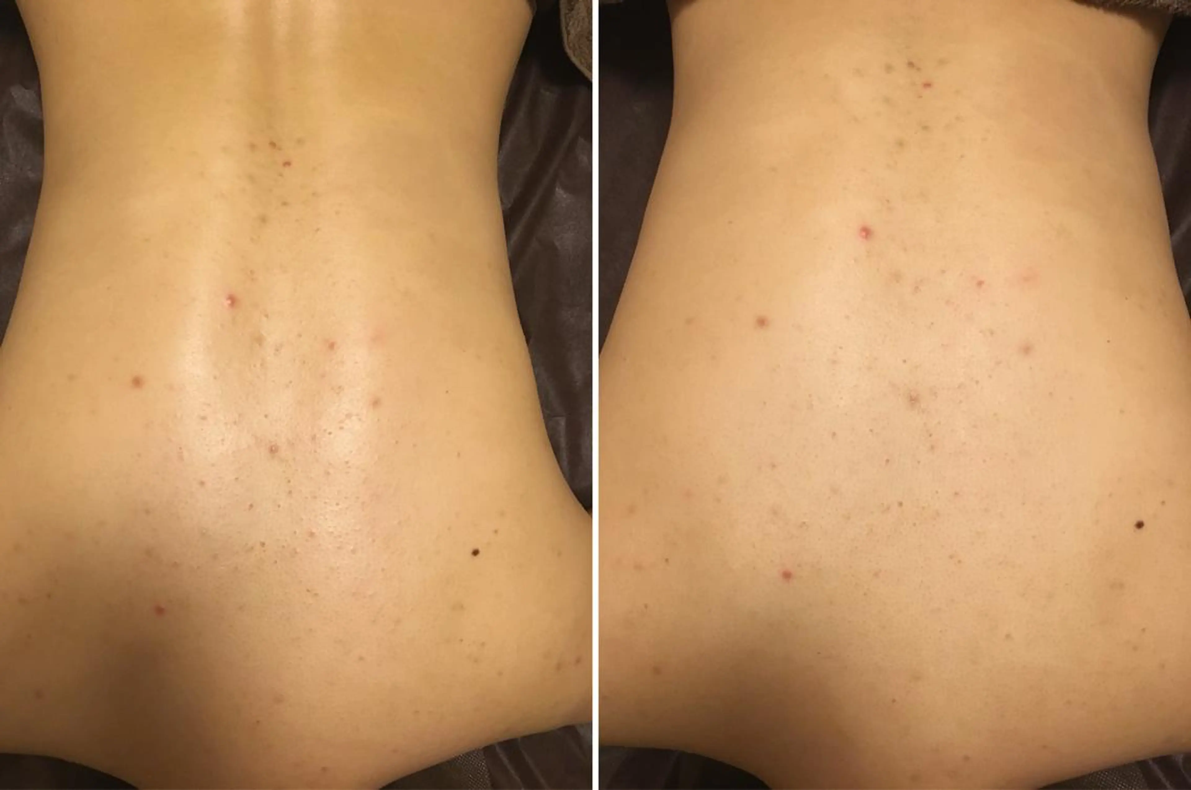 ミディアム カラー パーマ ヘアアレンジ メンズ キッズ ネイル マツエク・マツパ 赤色 アニメ,Vオタク× 即効痩せエステサロンのエステ・リラクイメージ