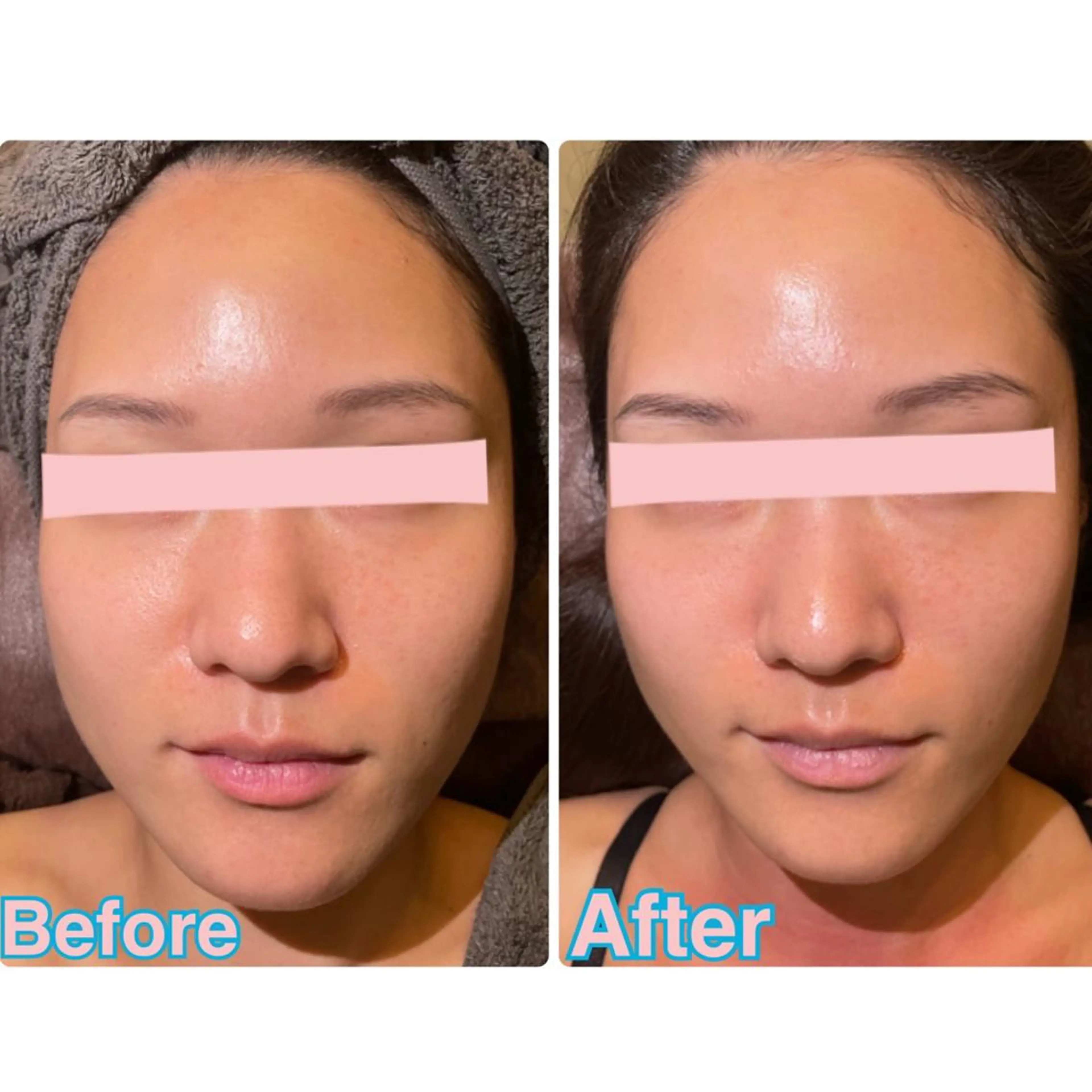 Beauty  Salon Twinkle所属・渡部 奈桜のエステ・リラクイメージ