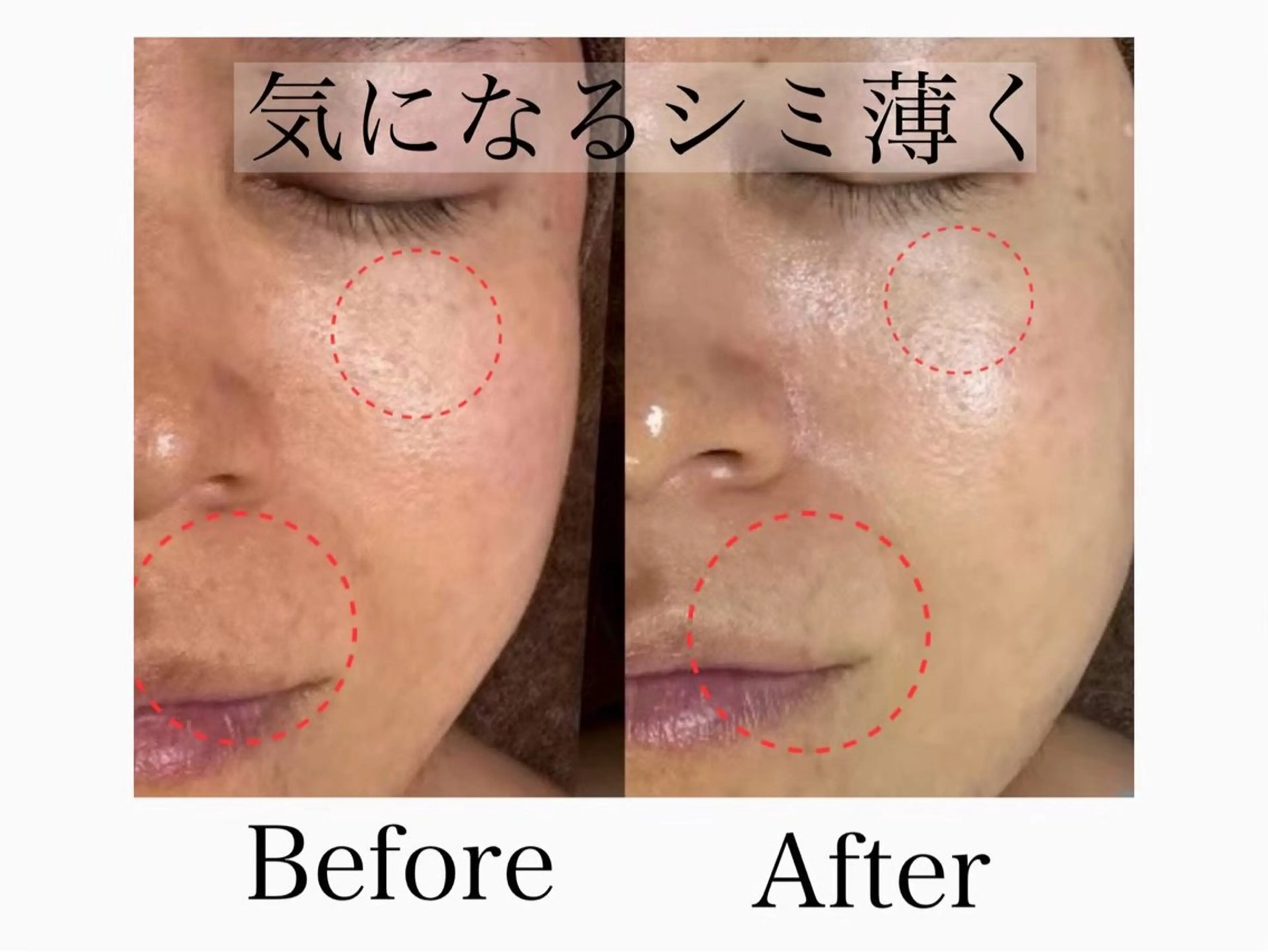 エステ 六本木/似合わせ眉毛 andＳ🍀Yuriのエステ・リラクイメージ