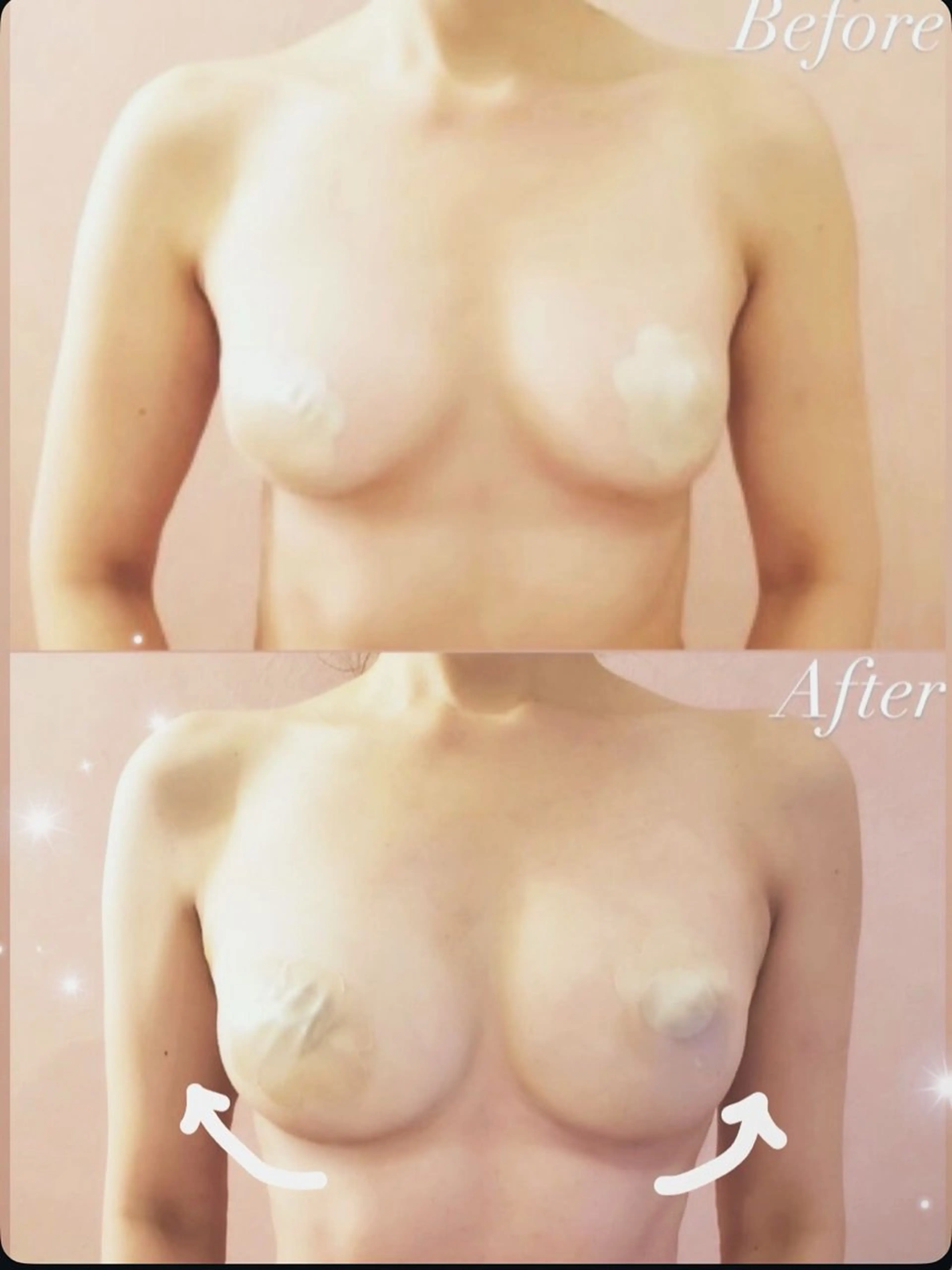 (ボリュームが欲しいあなたへ)全身＋手技＋最新機器のプレミアムコース✨️バストは全身から♡の写真