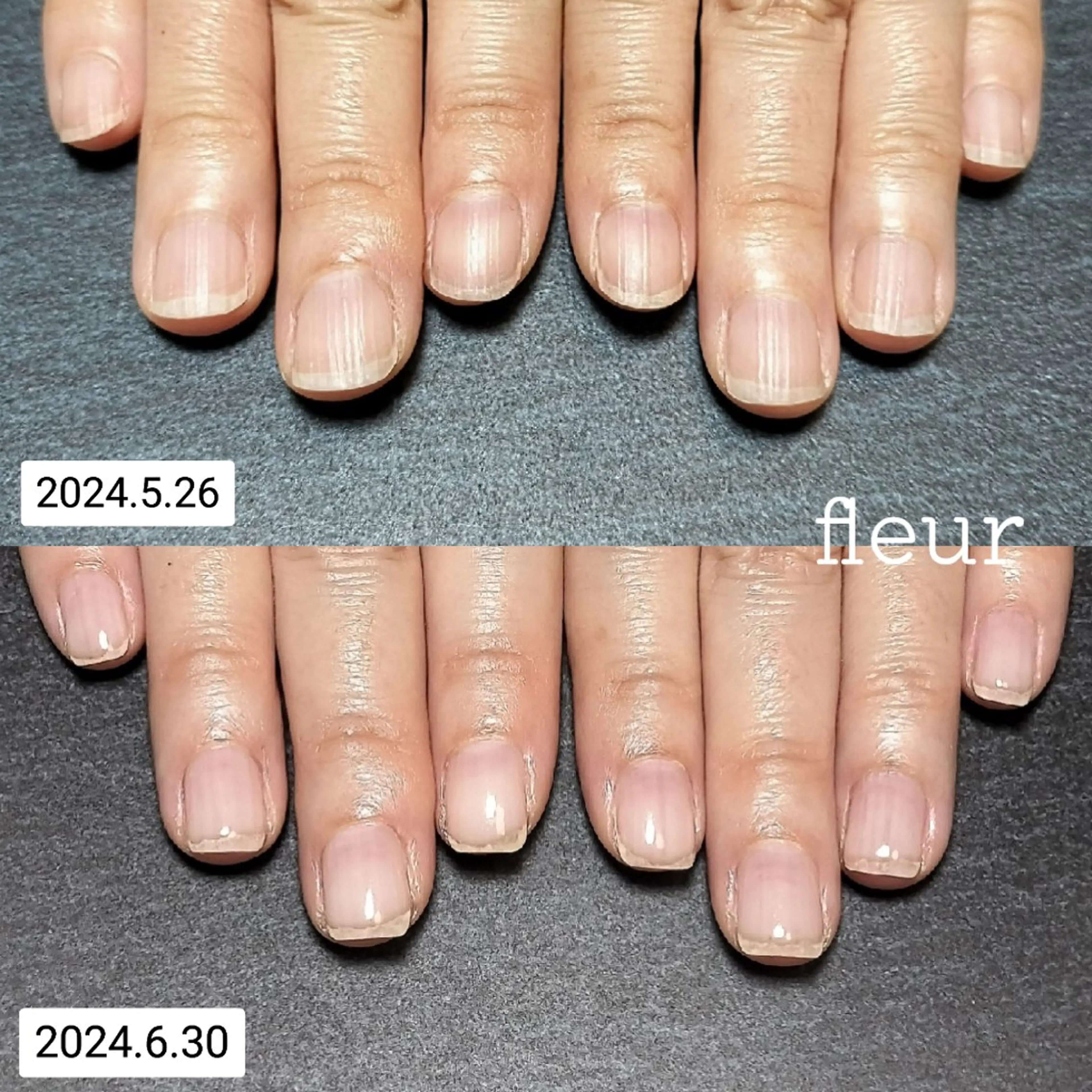 地爪育成(ジェル)オフ別途の写真