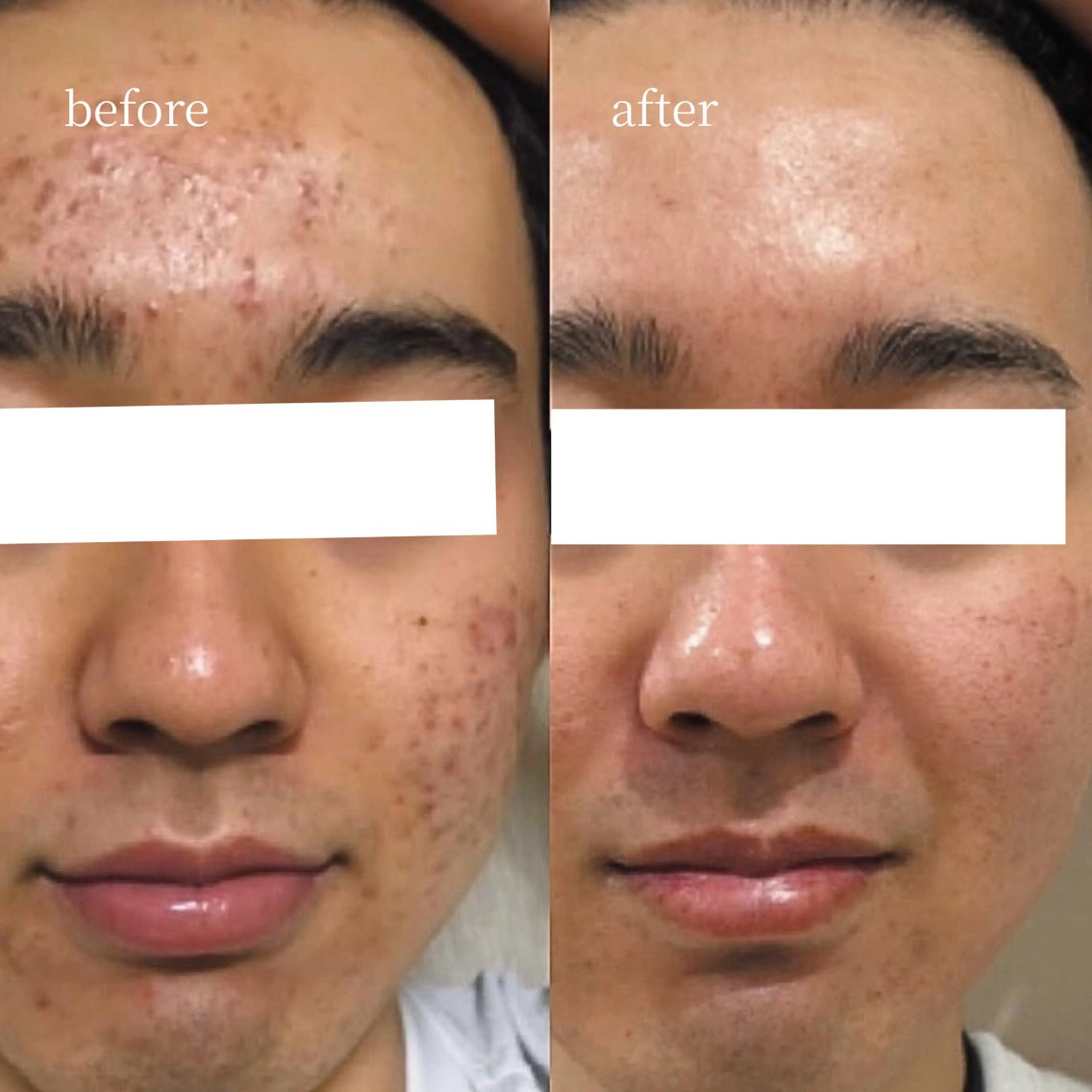 エステ 韓国肌管理・肌質改善 EARNEST心斎橋のエステ・リラクイメージ