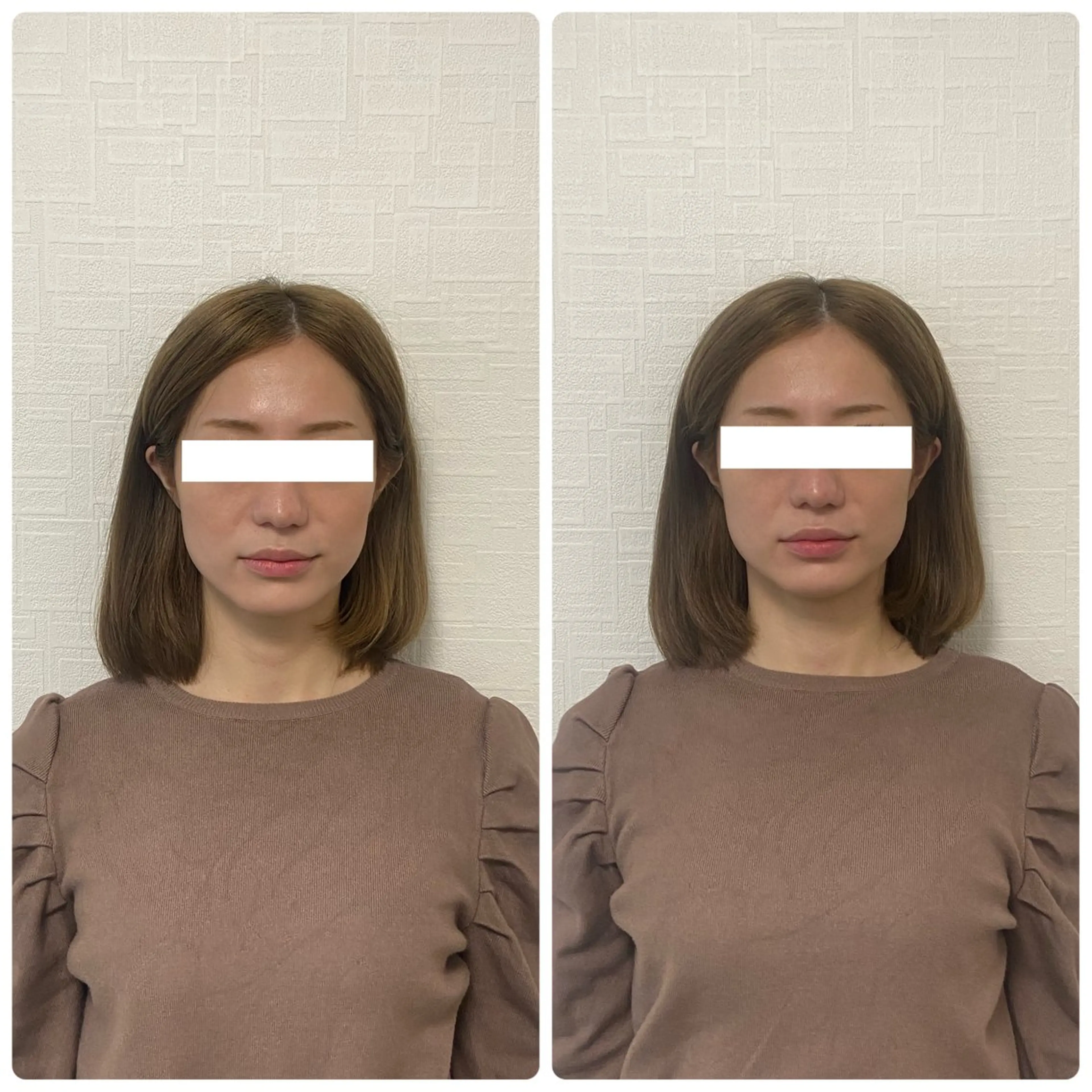 くつろぎ小顔サロン Lu mellow所属・片山けいこ｜ 美人顔創りの専門家のエステ・リラクイメージ