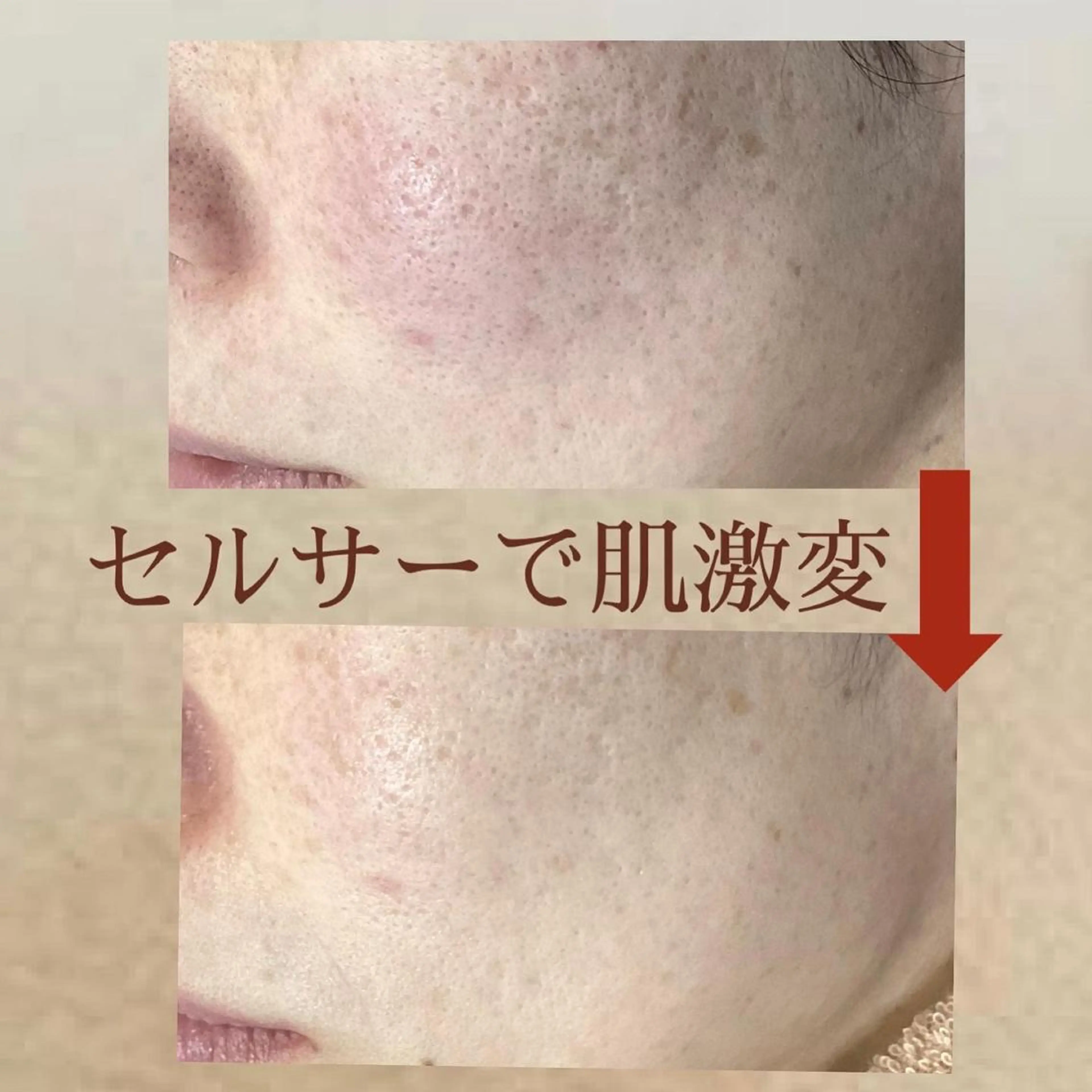 都度払い 肌質改善専門サロンのエステ・リラクイメージ