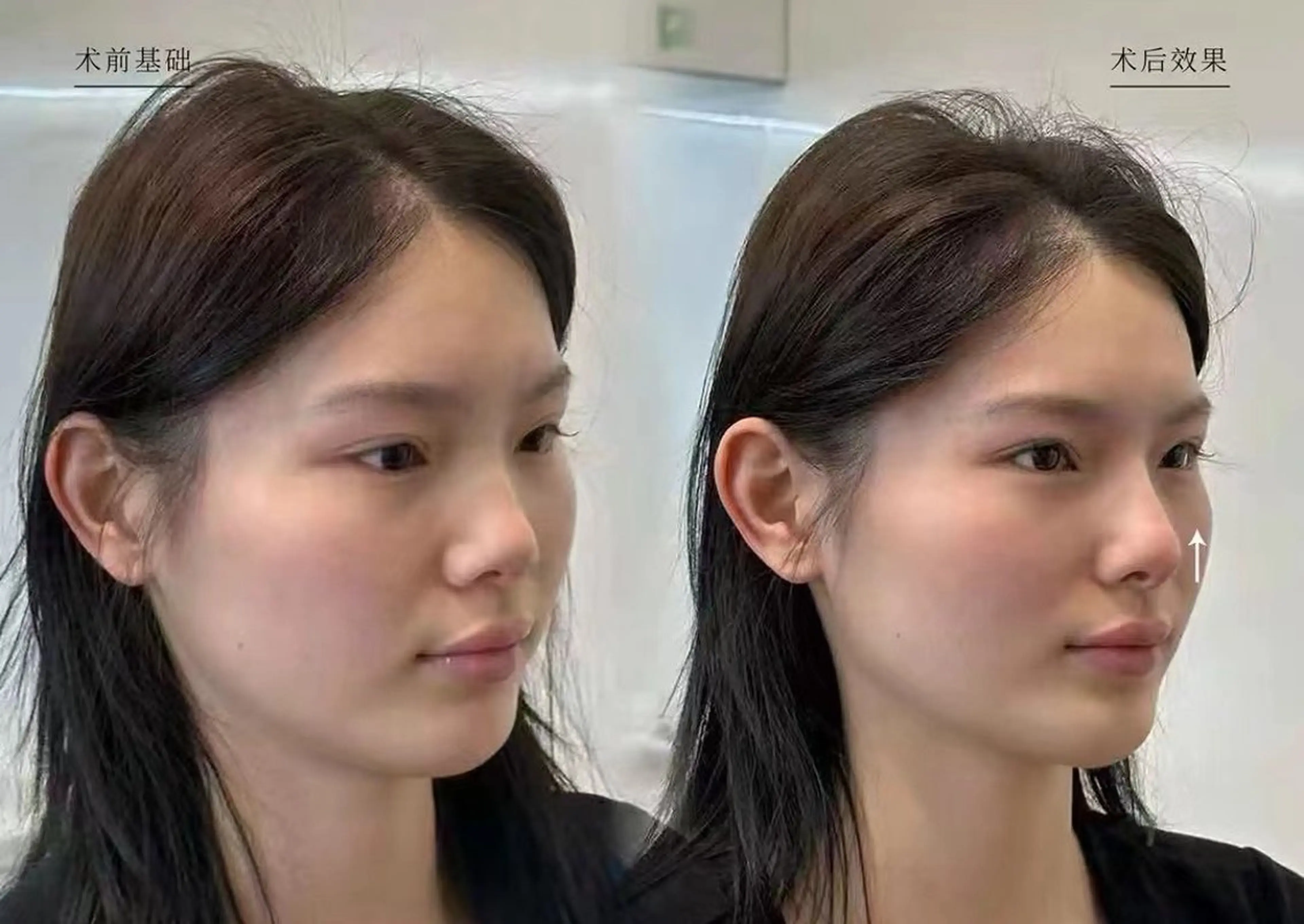 ネイル エステ aliaハイフ&水光ジェットサロン所属・aliaハーブ水光店 エステティシャン募集のエステ・リラクイメージ