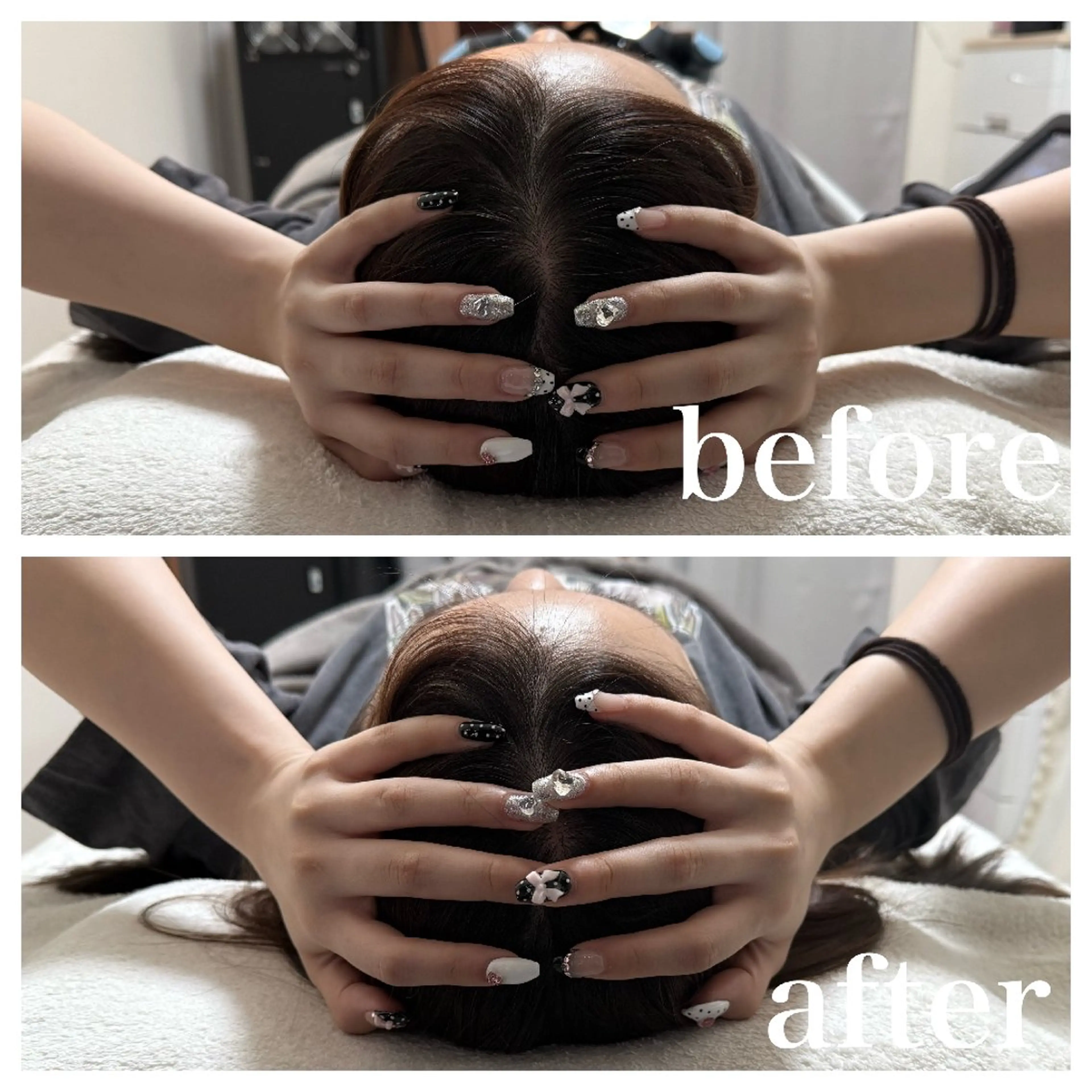 エステ リラク 医療提携Ruby所属・医療提携Ruby小顔 ハーブピーリングのその他イメージ