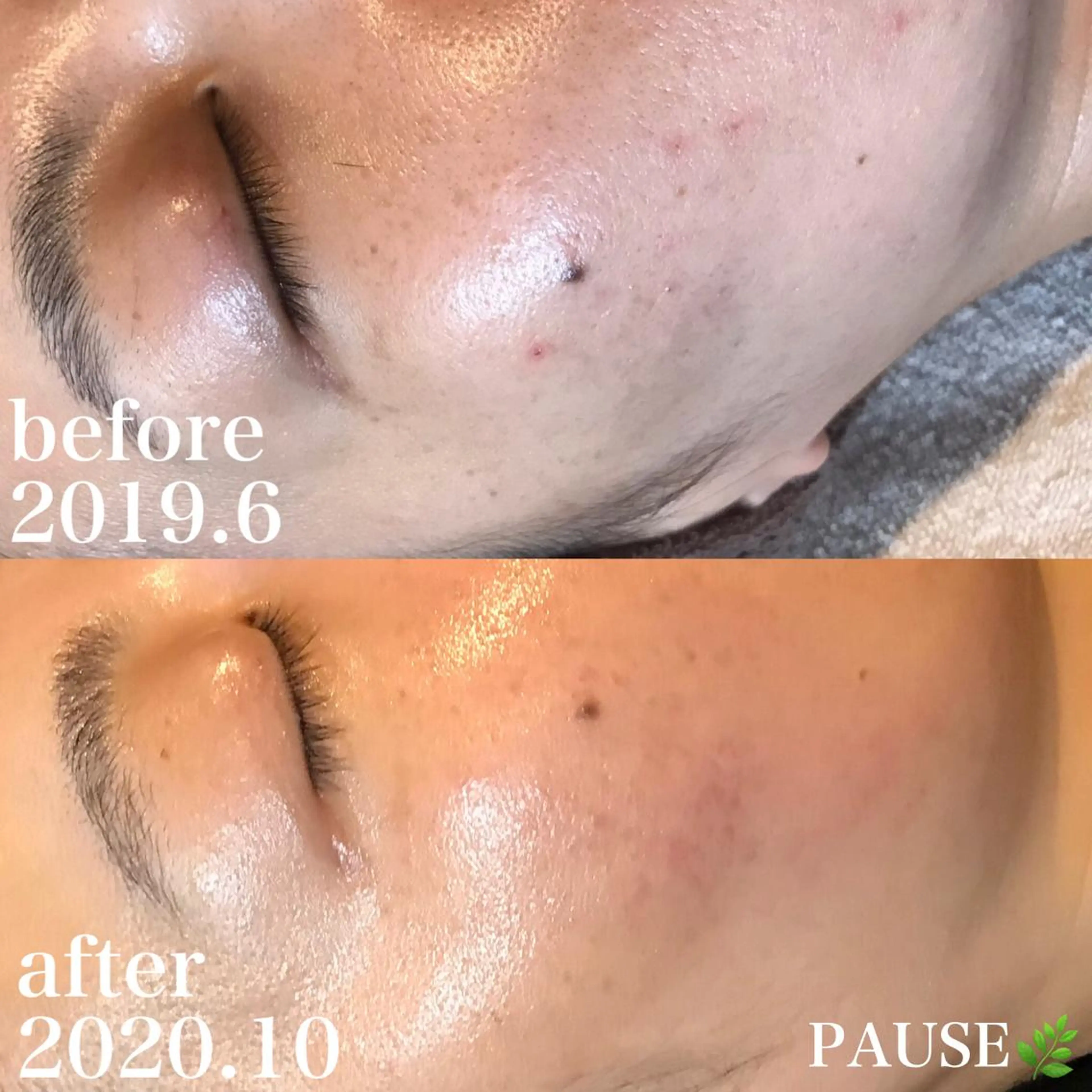 エステ 浜野 恵美のエステ・リラクイメージ