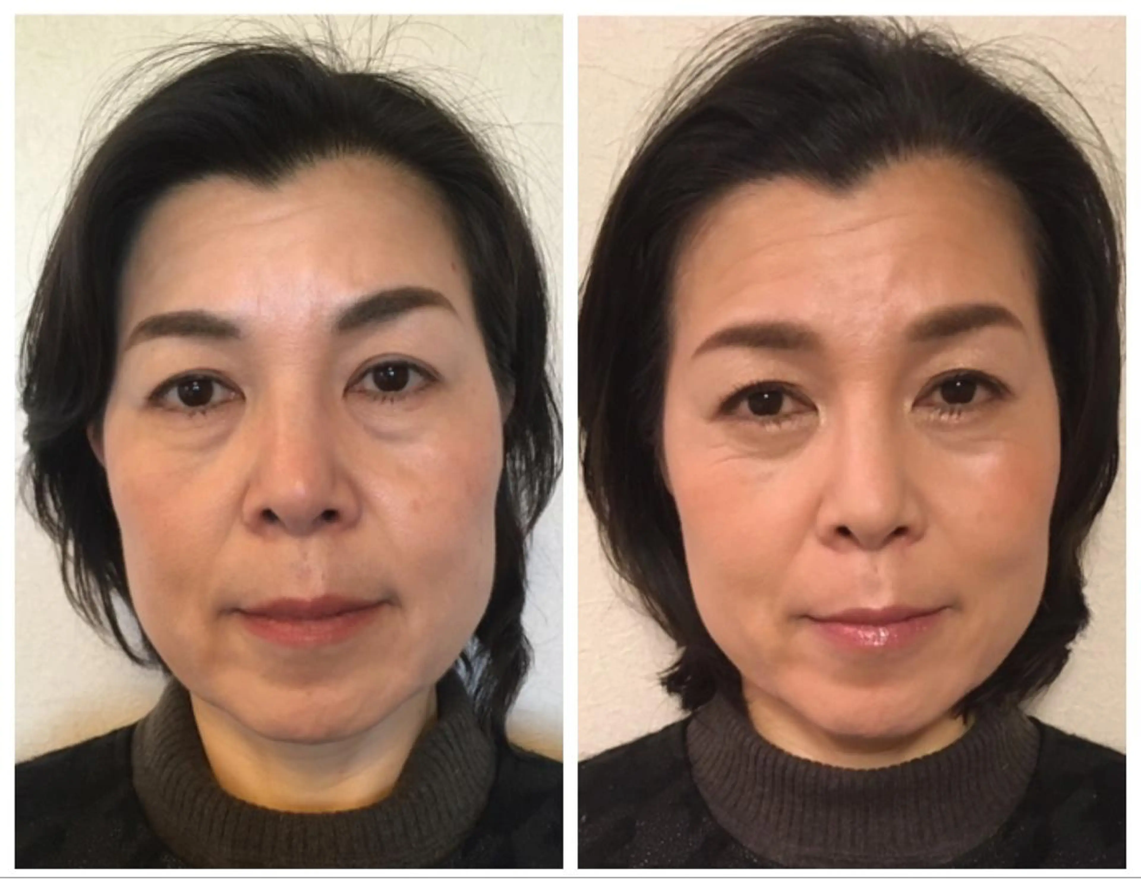 アイブロウ Leading Ladiesのエステ・リラクイメージ