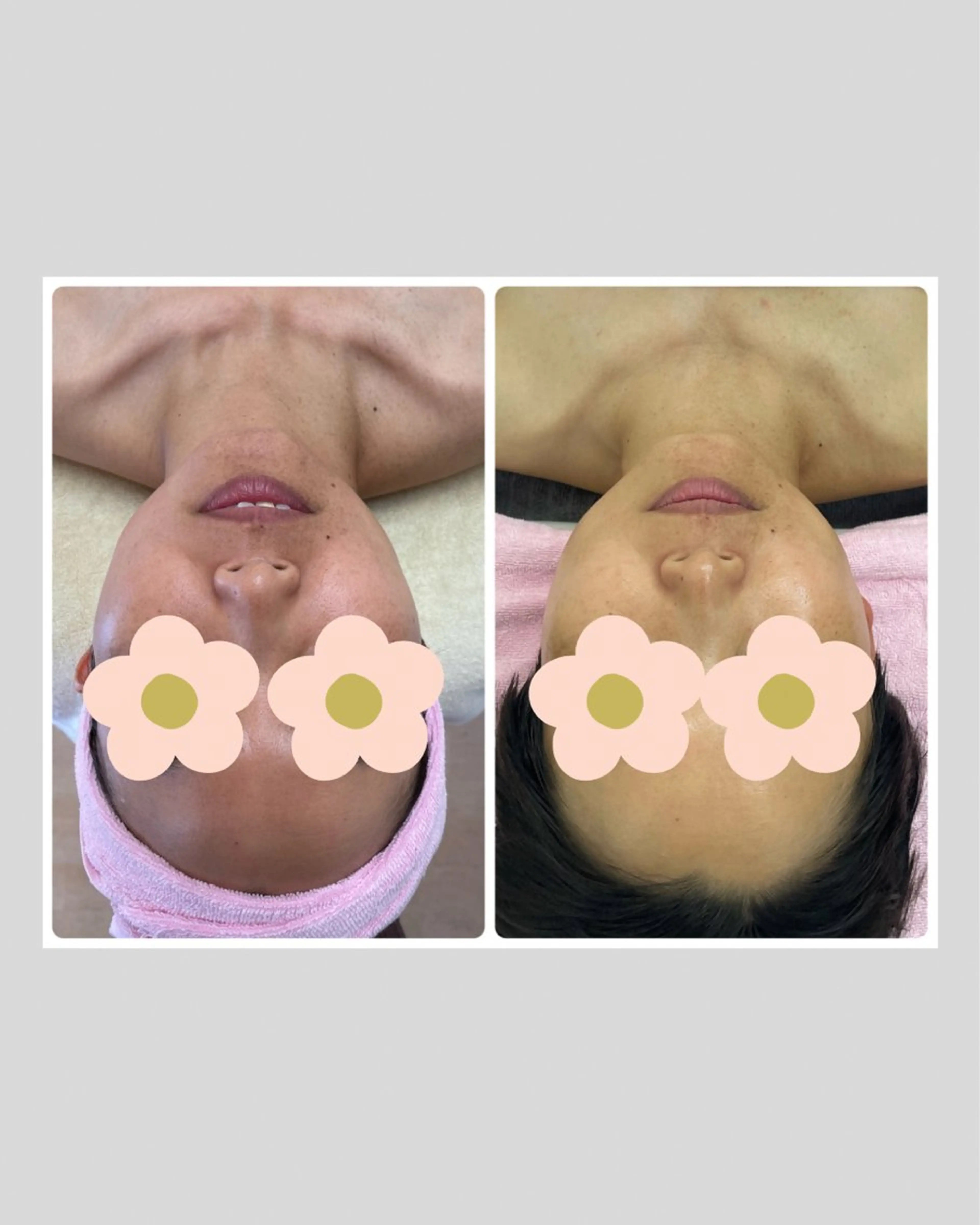 Salon Rion所属・Rion 野々村のエステ・リラクイメージ