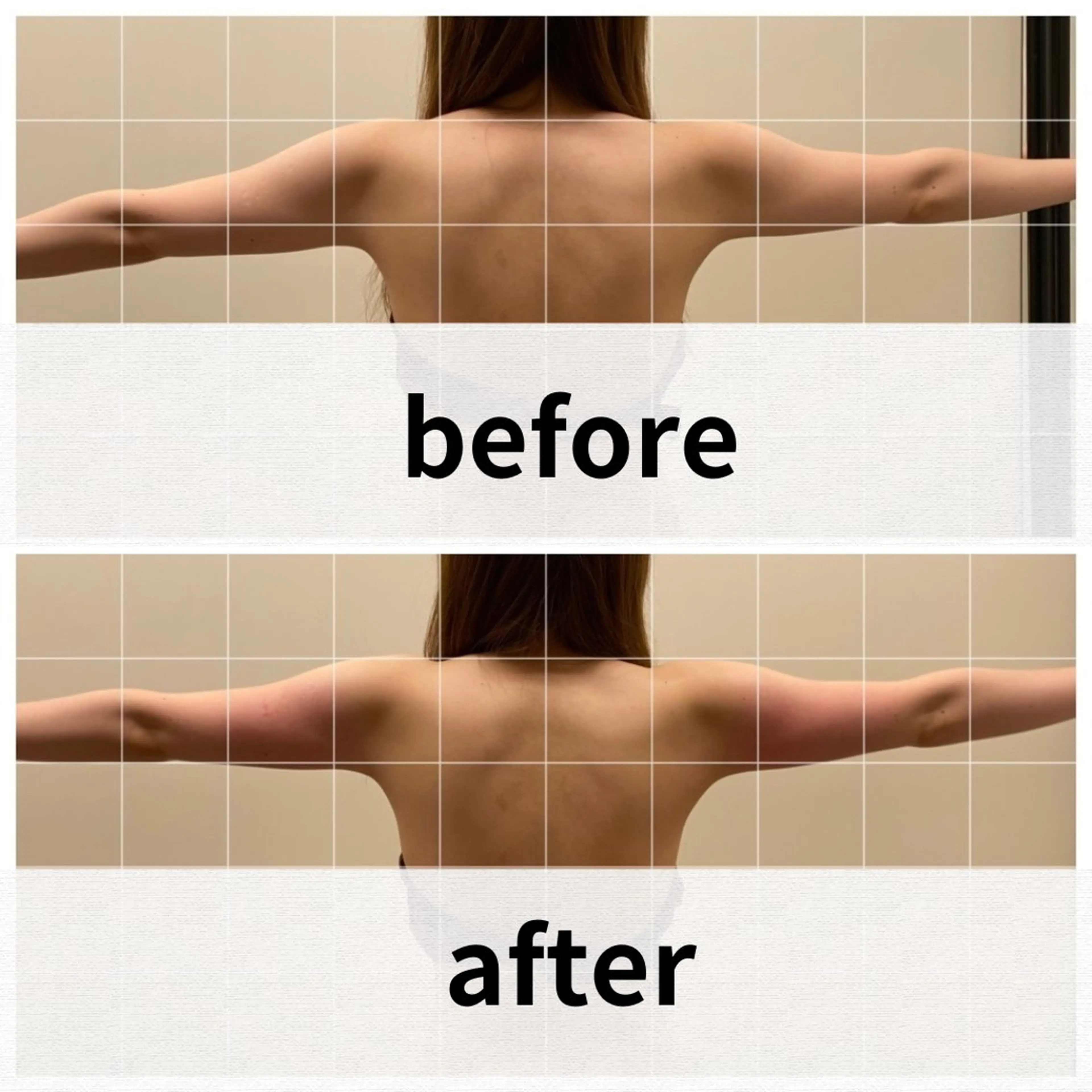 美容鍼/ヘッドスパ/ 💎さかもとのエステ・リラクイメージ