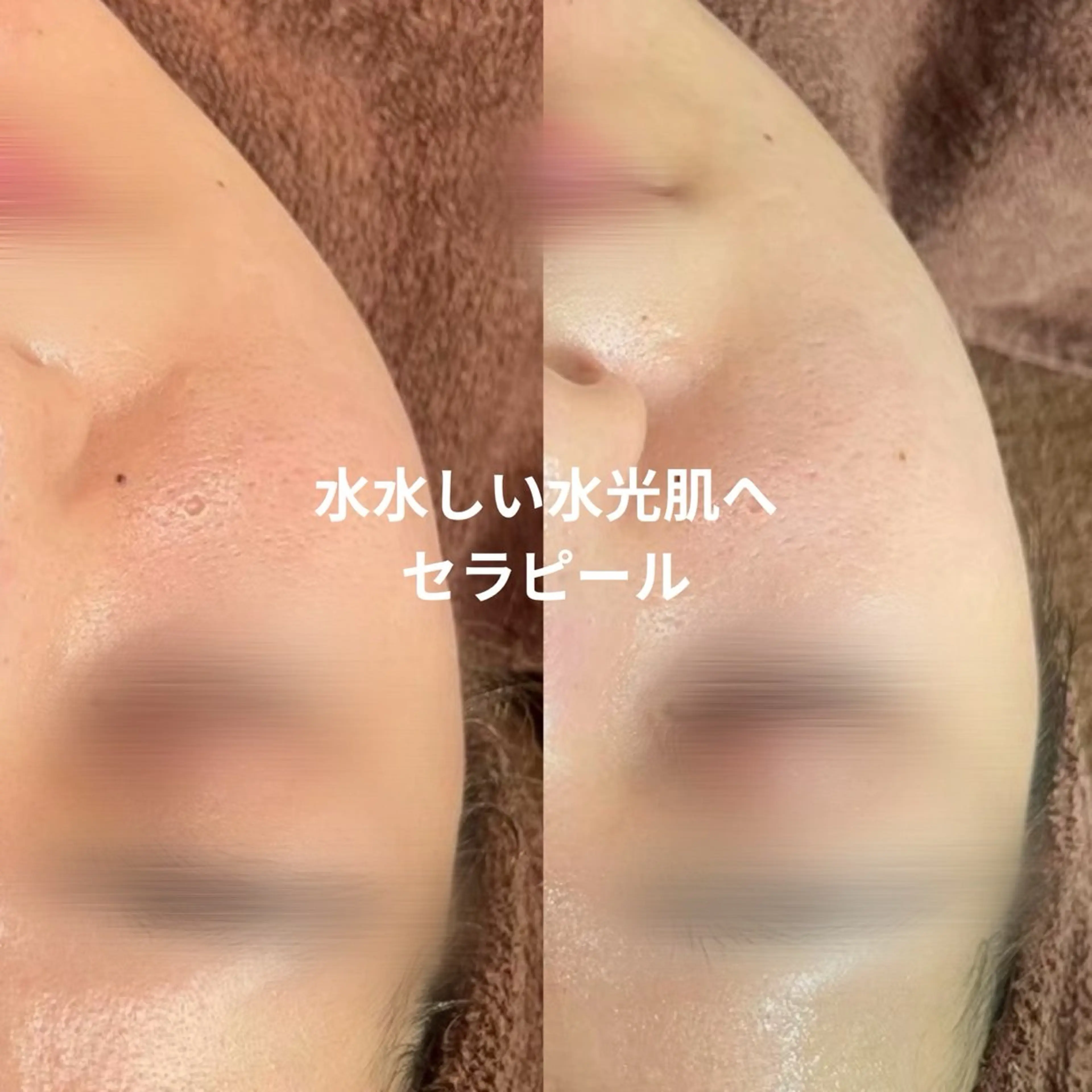 【LEPUS】レプス nishimoriのエステ・リラクイメージ