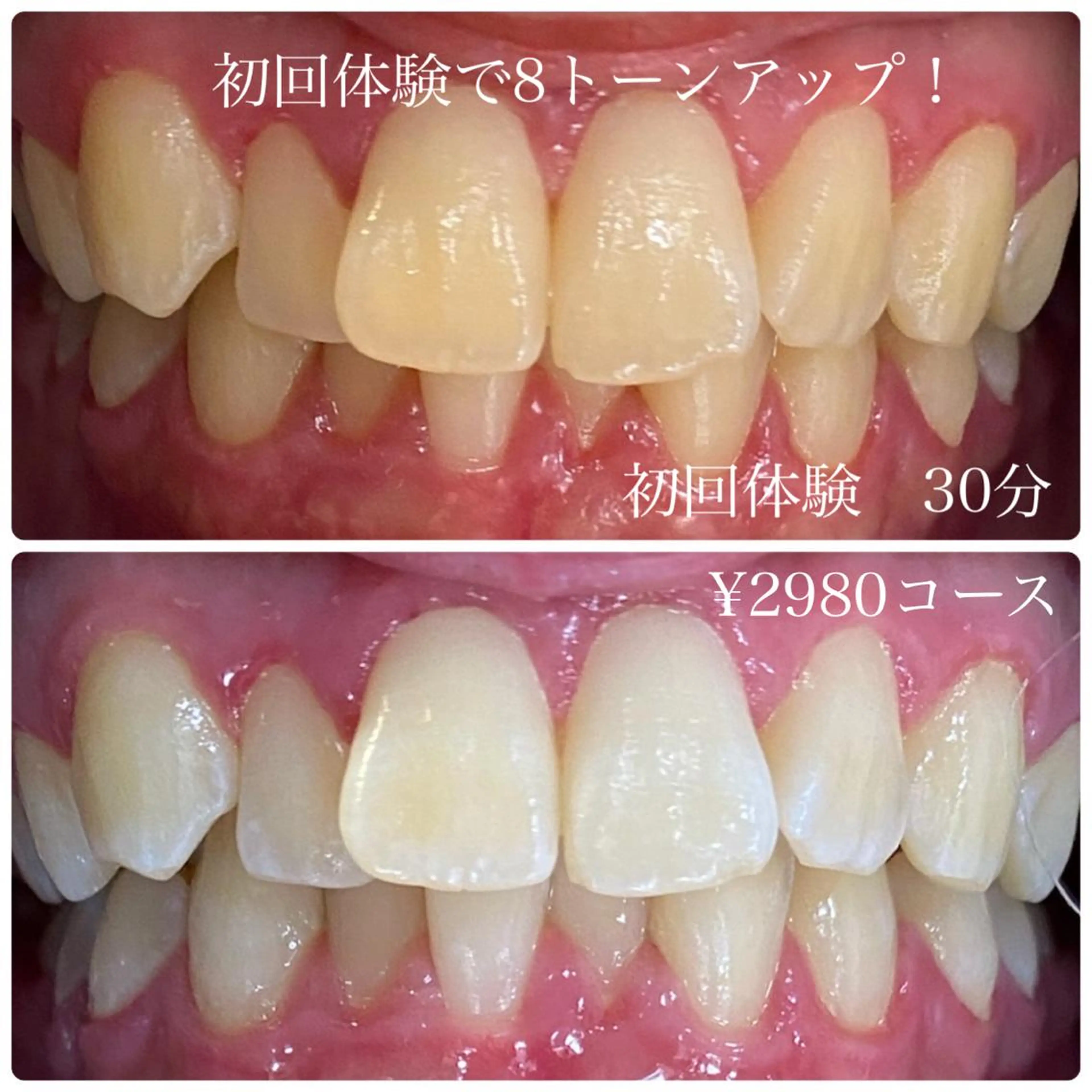 その他 ホワイトニングルーム　川崎店所属・ホワイトニング ルーム　川崎店のその他イメージ